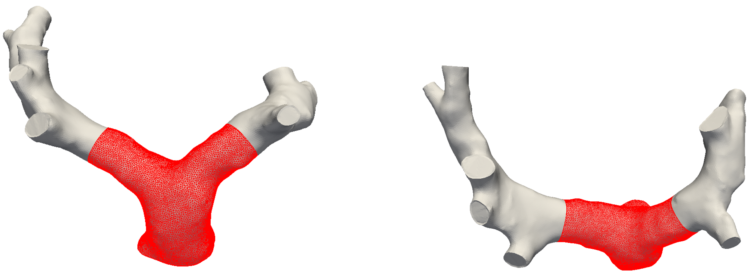 Fluids 04 00190 g0a1