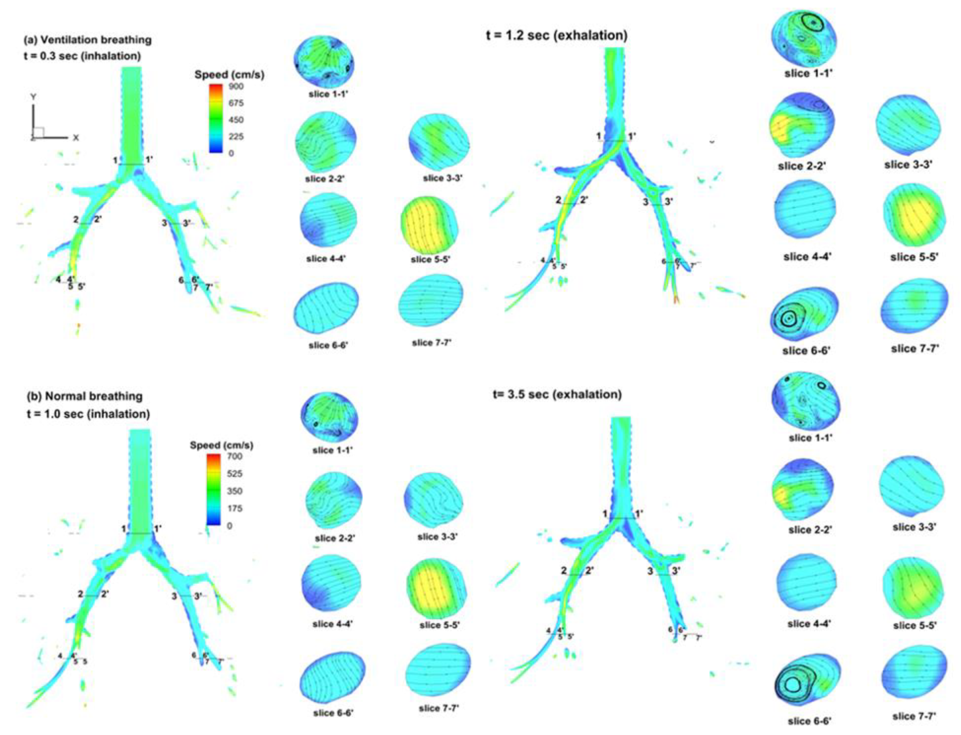 Fluids 06 00388 g005 550