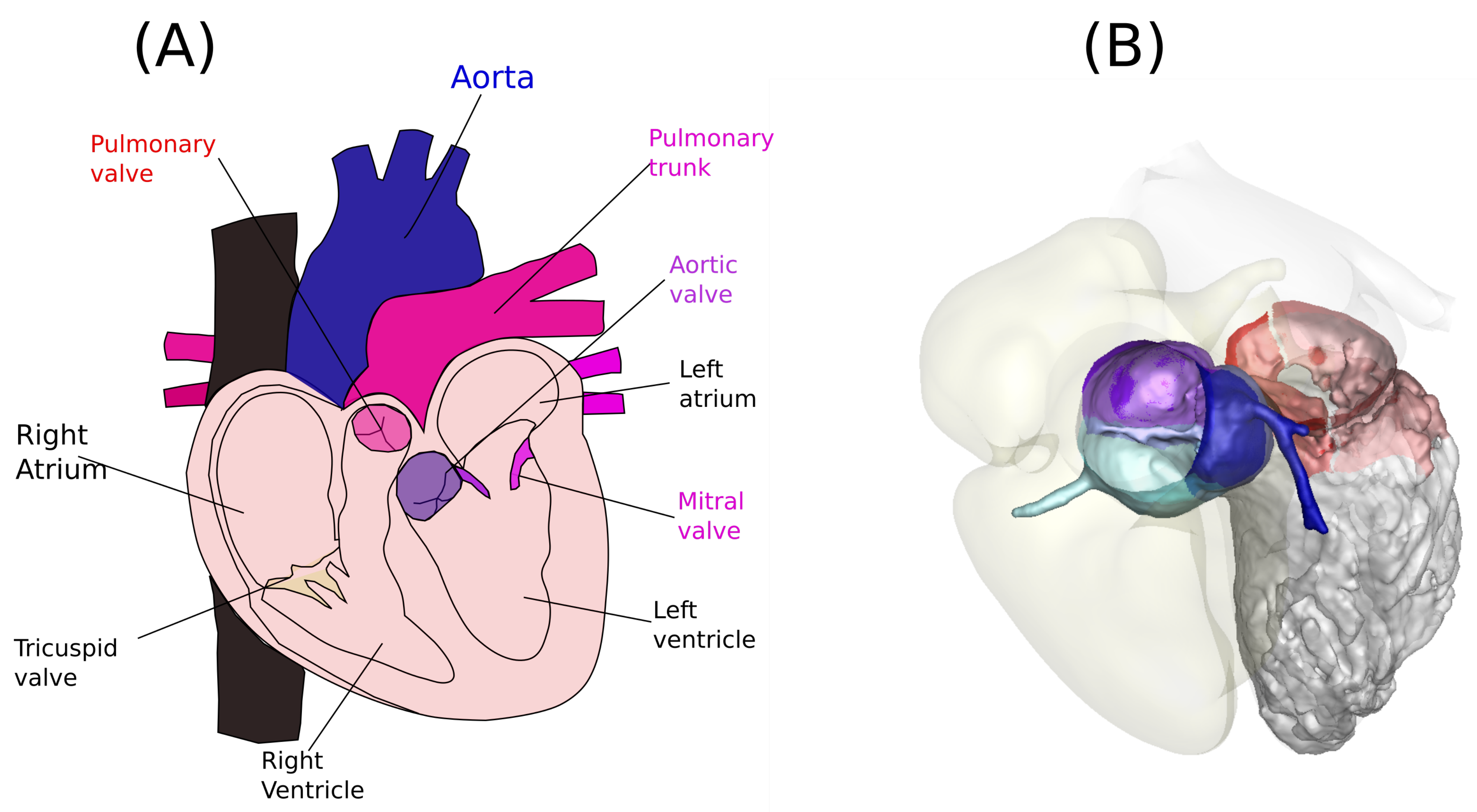 On-X versus St Jude Medical Regent mechanical aortic valve prostheses:  early haemodynamics
