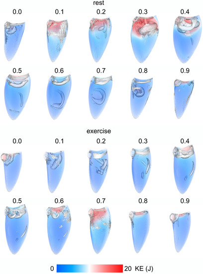 Hemodynamic Assessment of the Pathological Left Ventricle Function ...