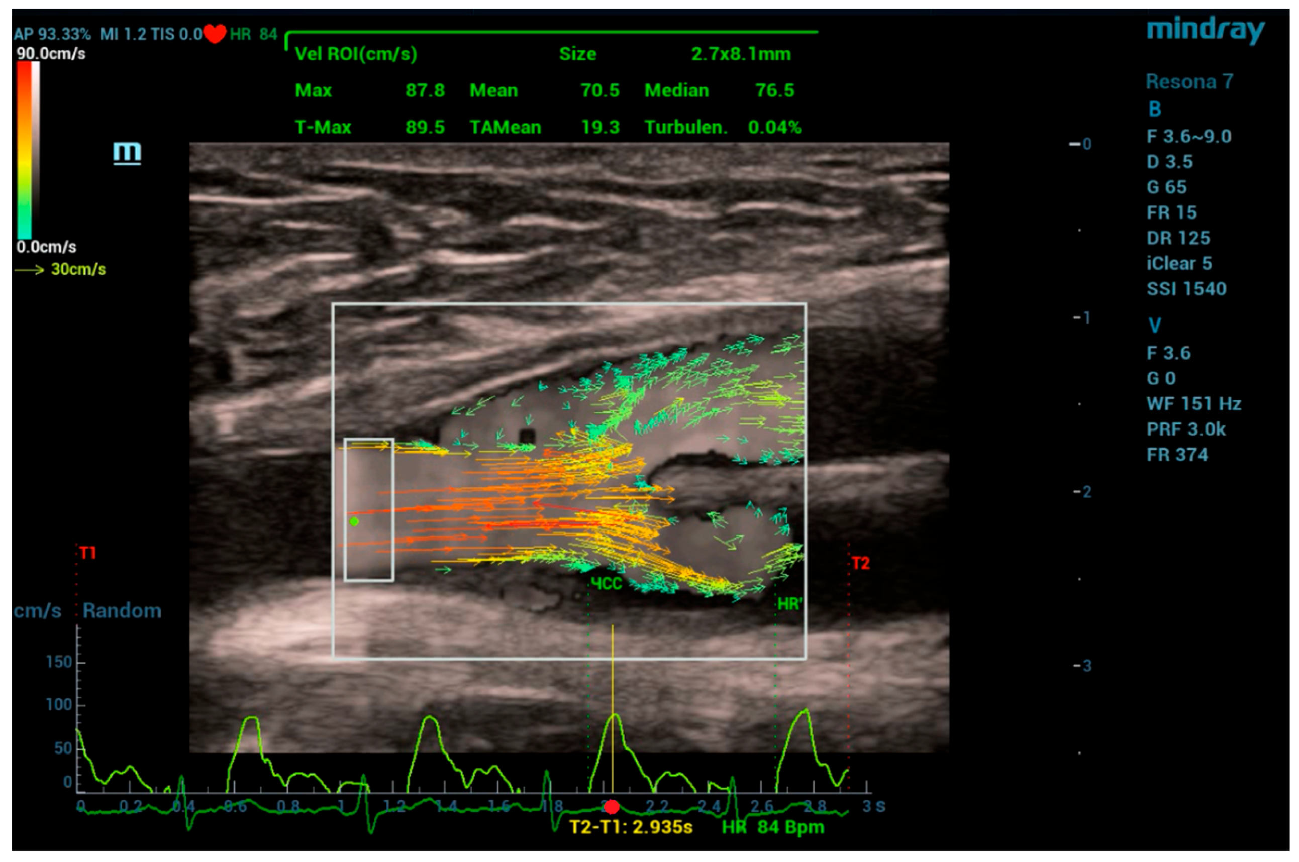 Fluids 09 00064 g004