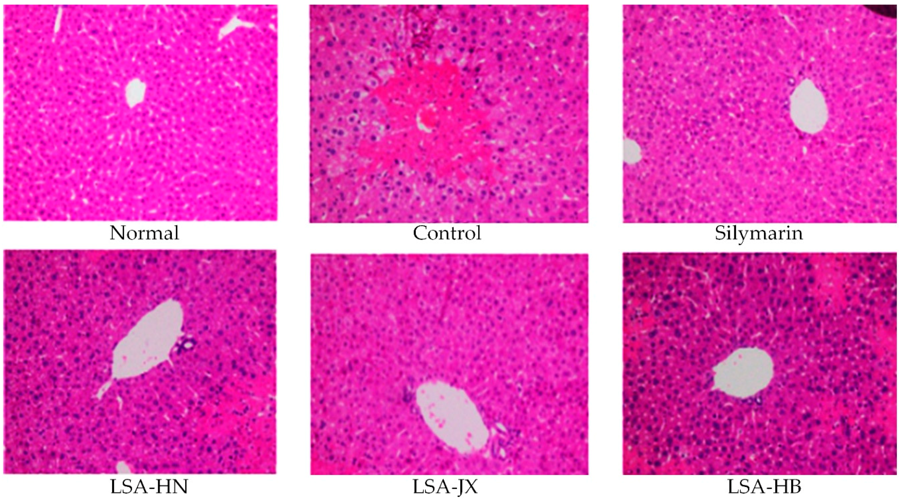 Foods Free Full Text Preventive Effect Of Alkaloids From Lotus Plumule On Acute Liver Injury In Mice Foods Free Full Text Preventive Effect Of Alkaloids From Lotus Plumule On Acute Liver Injury In Mice
