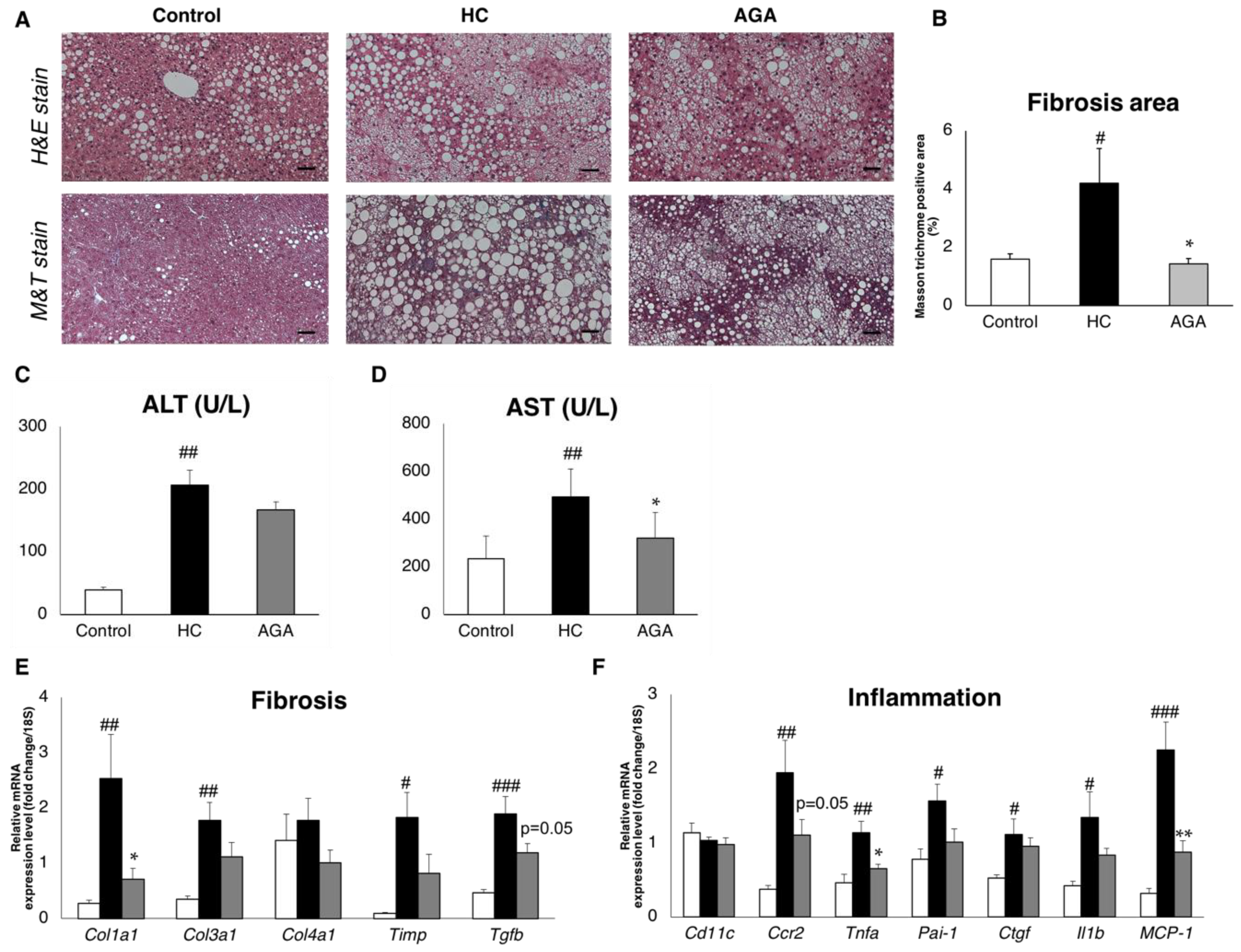 Phd thesis of oxidative stress antioxidants in alcoholic liver diseases