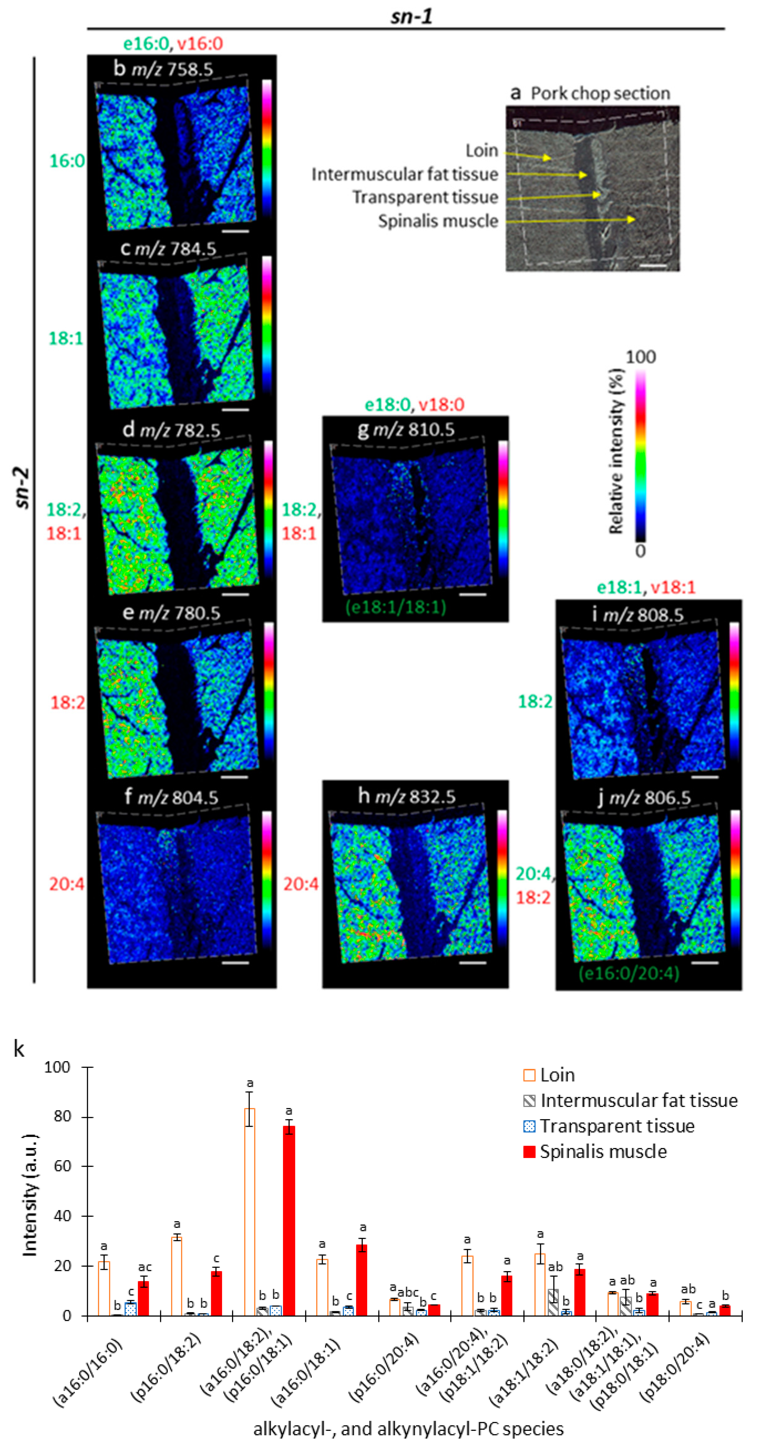 Foods Free Full Text Unique Distribution Of Diacyl Alkylacyl And Alkenylacyl Phosphatidylcholine Species Visualized In Pork Chop Tissues By Matrix Assisted Laser Desorption Ionization Mass Spectrometry Imaging Html