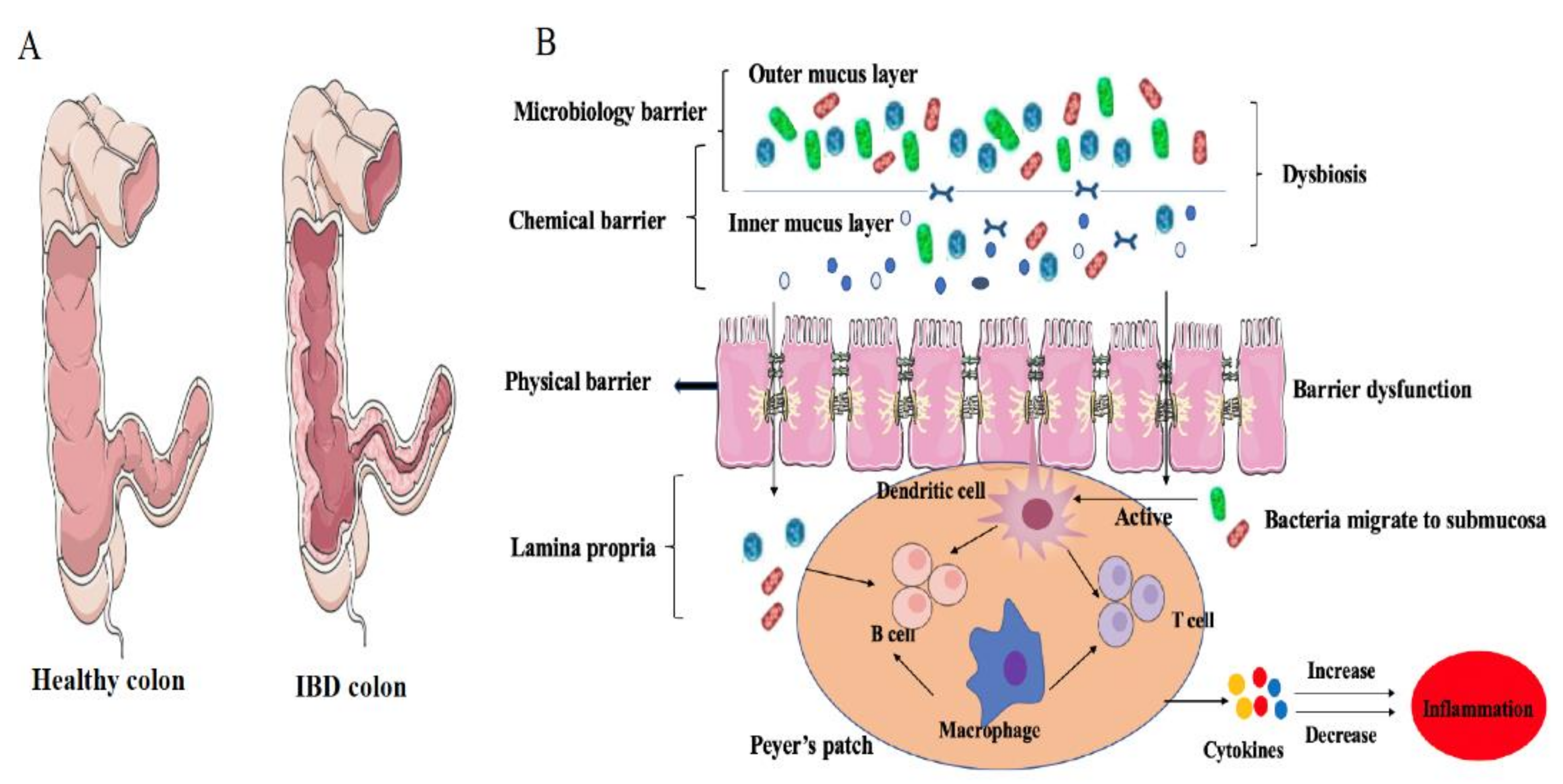 Dietary Regulation of the Crosstalk between Gut Microbiome and