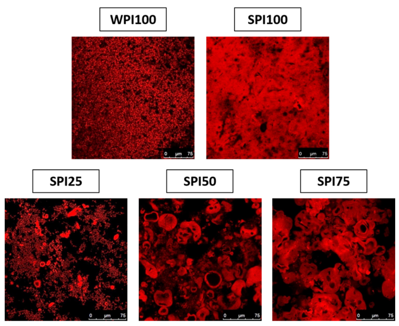 Foods Free FullText Microstructural Analysis of Whey/Soy Protein