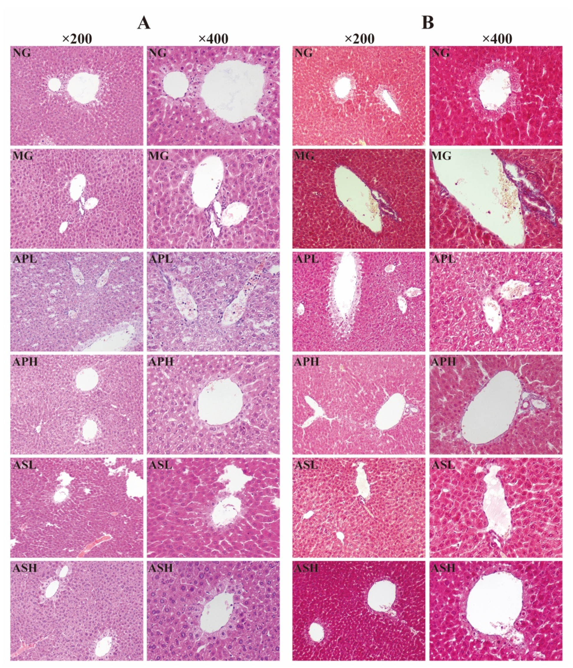 Foods 10 02688 g007 550