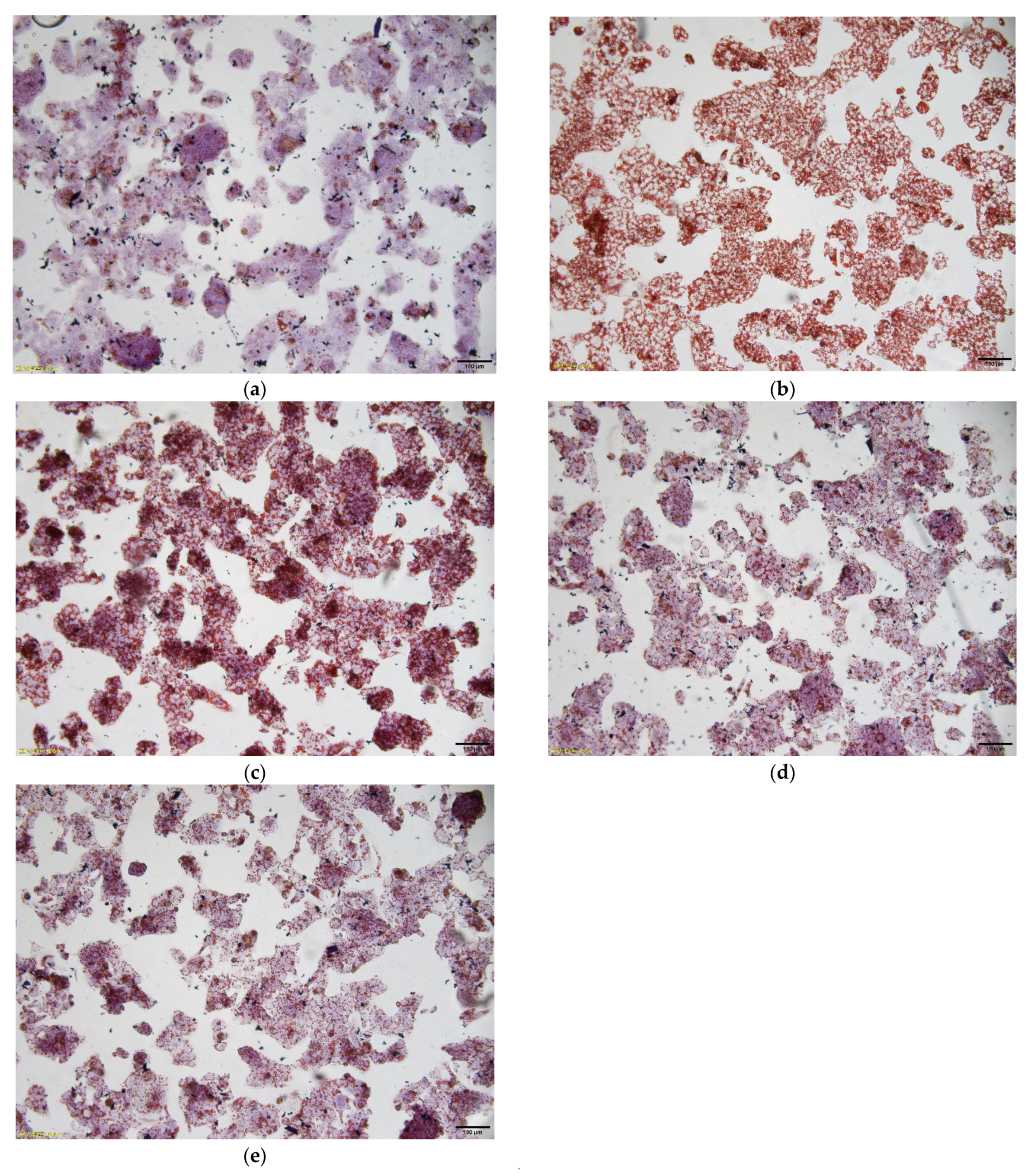 Foods Free Full Text Lipid Lowering Effects Of Inonotus Obliquus Polysaccharide In Vivo And In Vitro Html