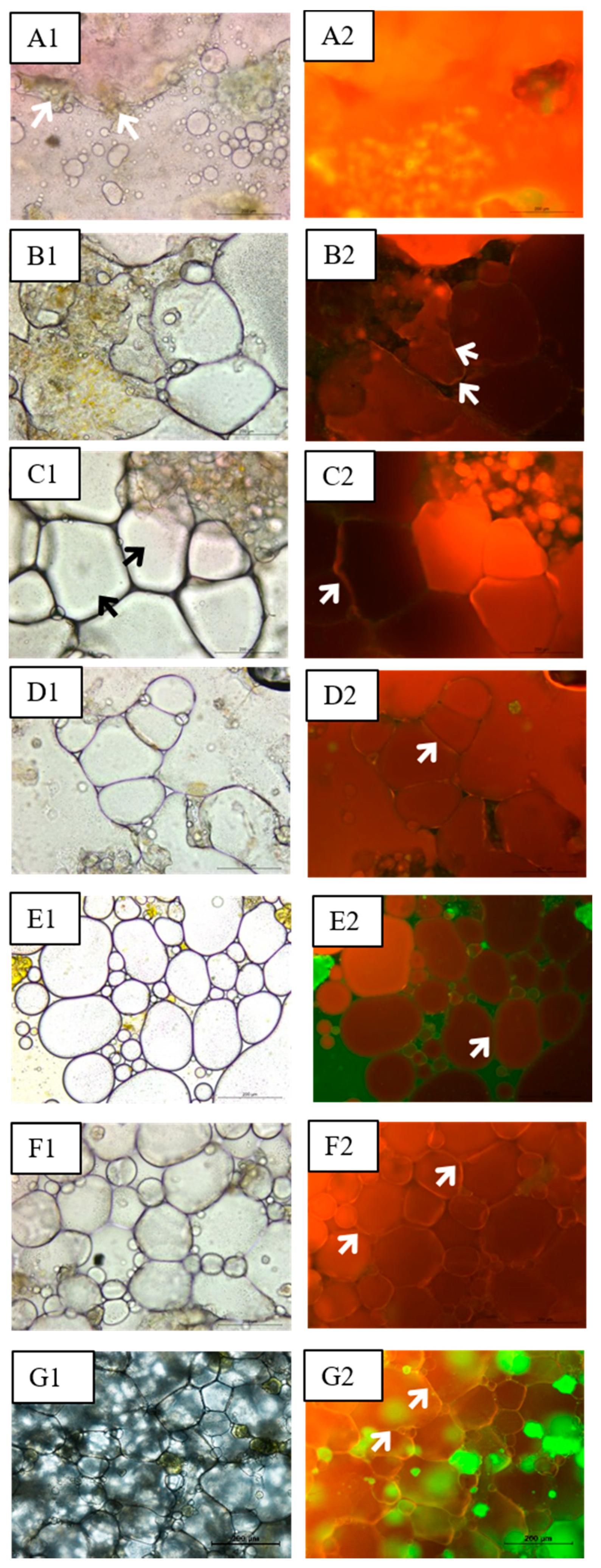 Foods 11 00994 g004 550