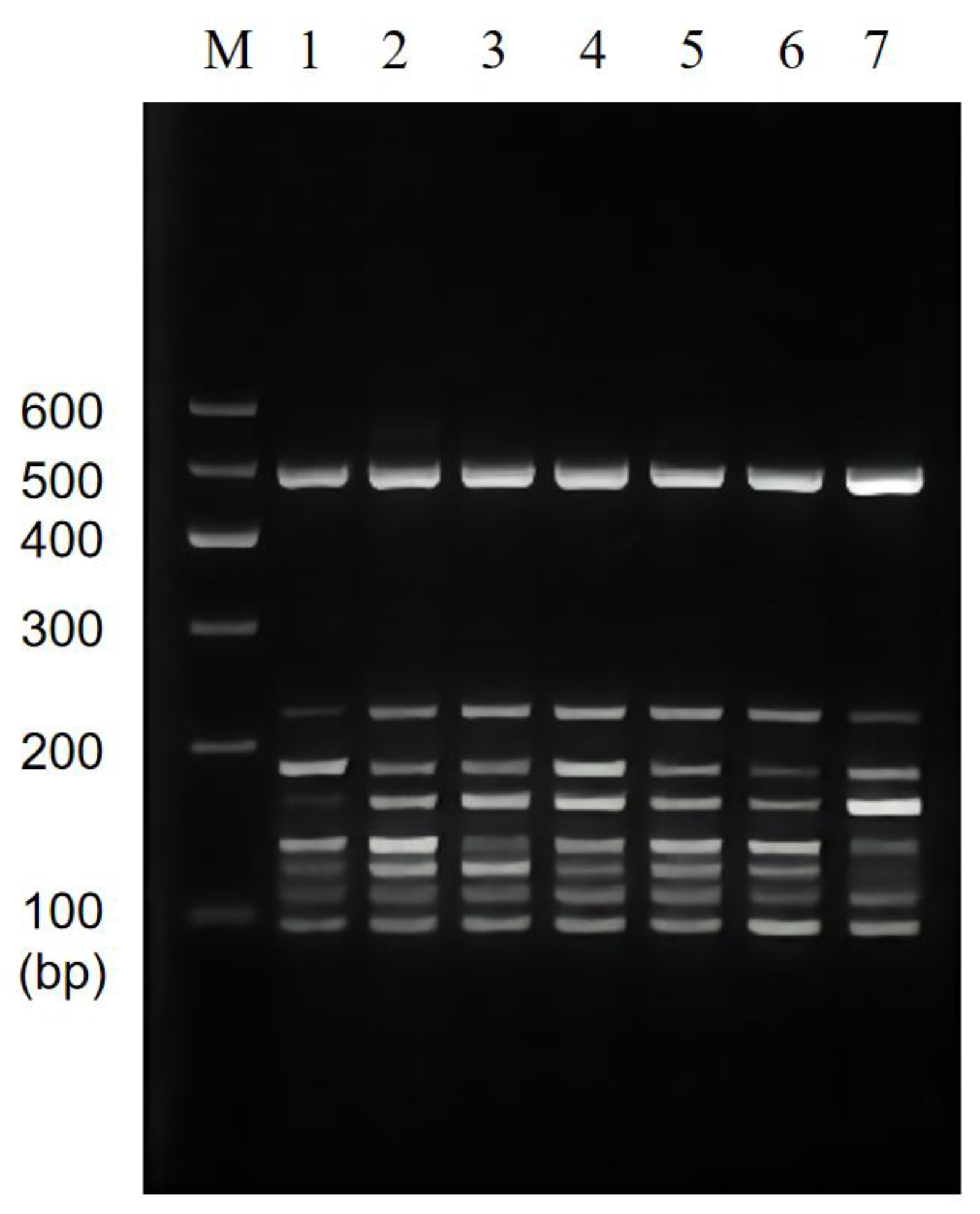 The Detection of Foodborne Pathogenic Bacteria in Seafood Using a