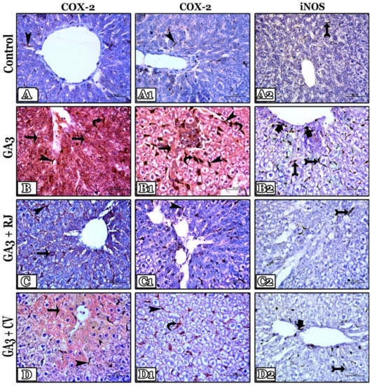 Foods Free FullText Royal Jelly and Chlorella vulgaris Mitigate