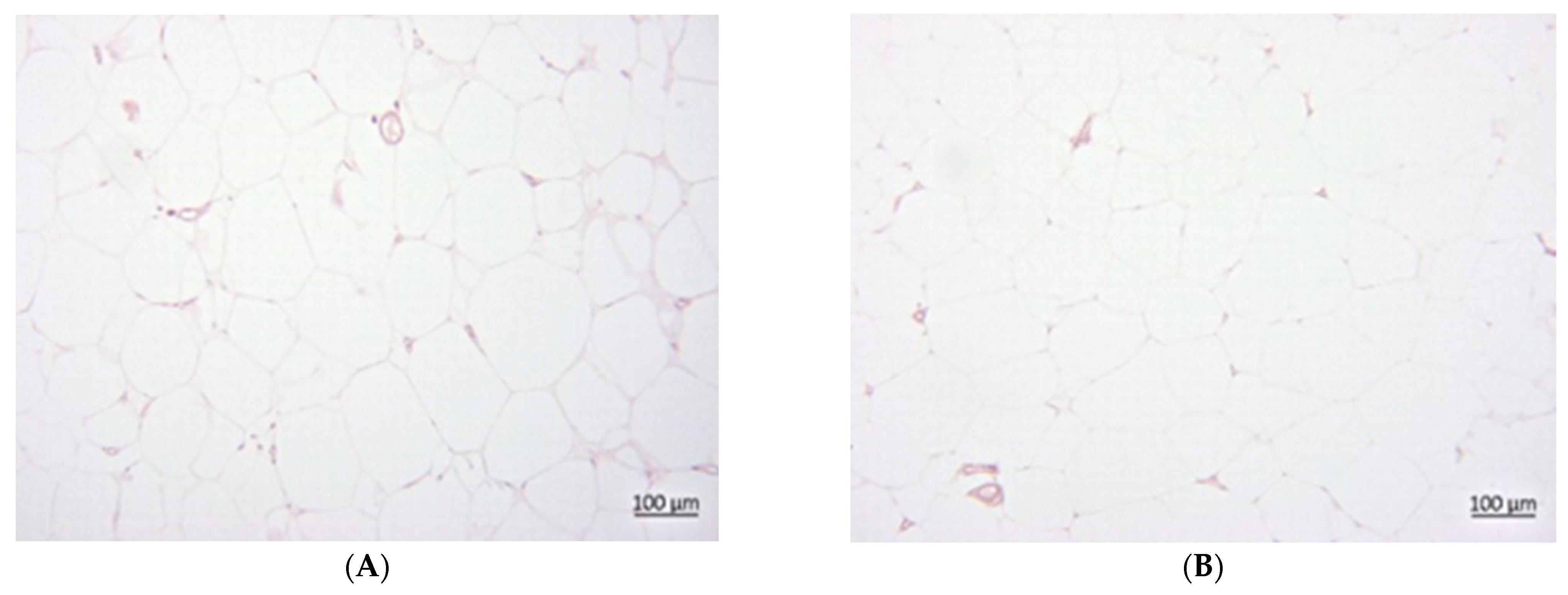 Foods 14 02038 g004a