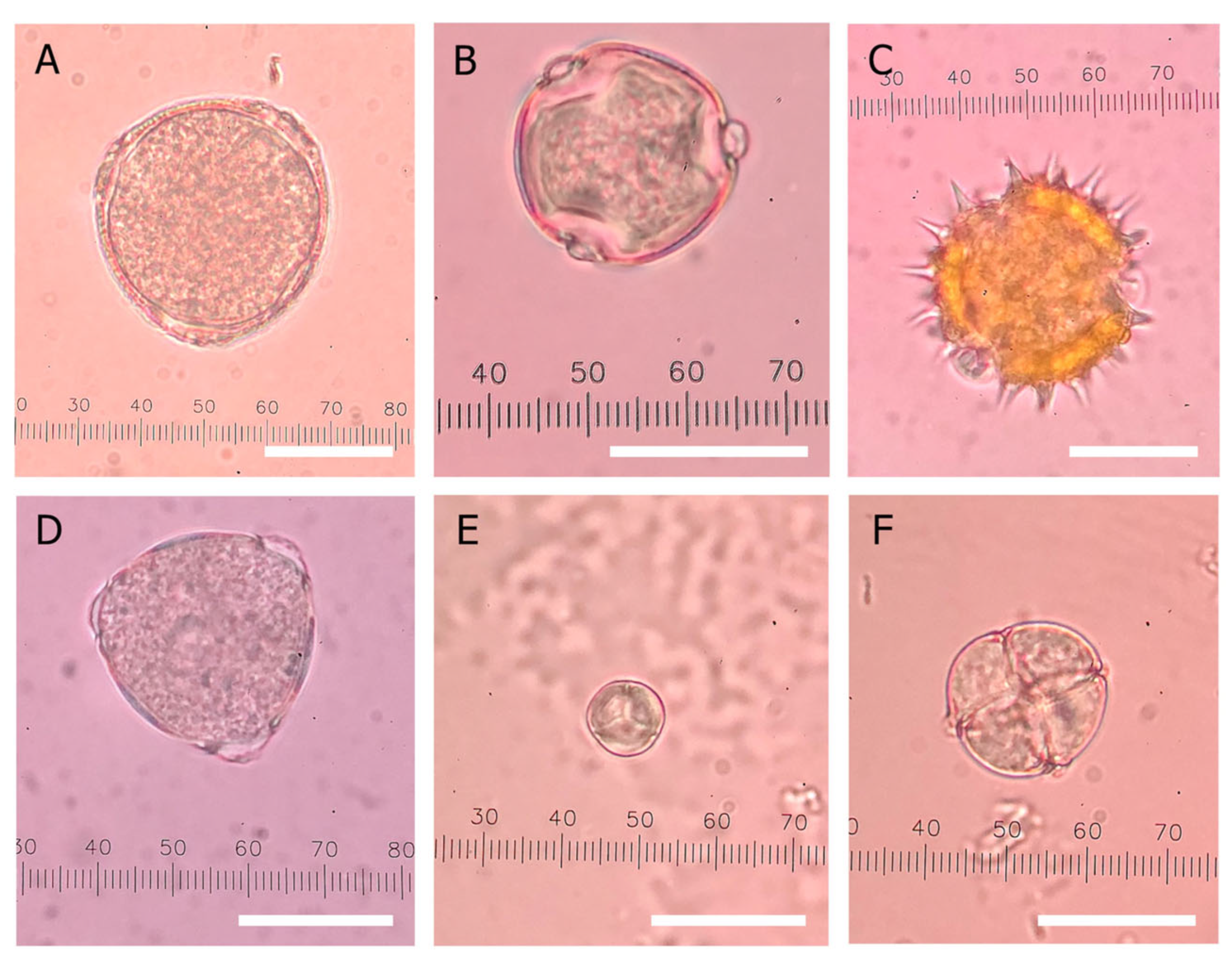 Foods 14 03850 g007 Foods 14 03850 g007