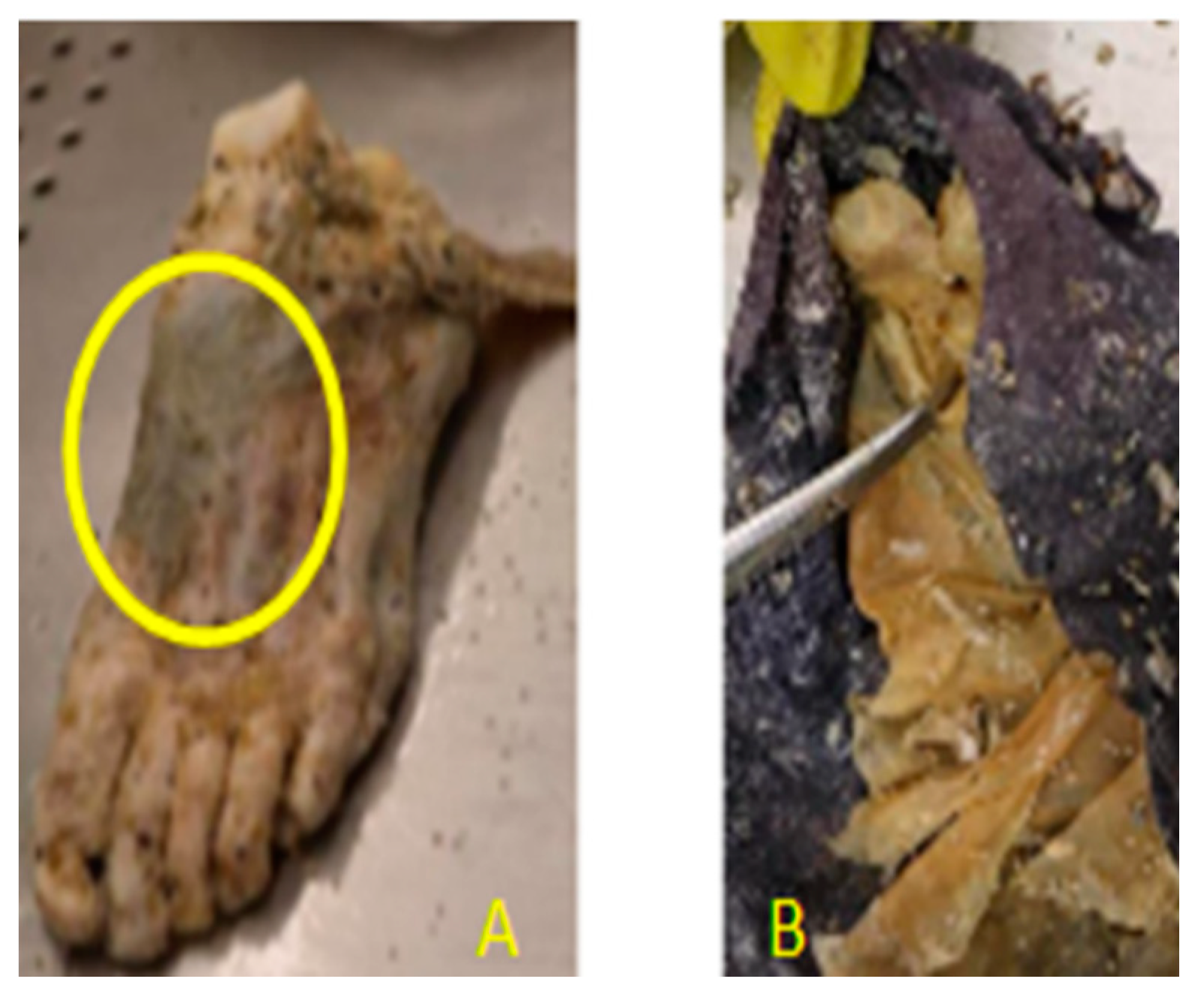 Forensicsci 01 00013 g005 550