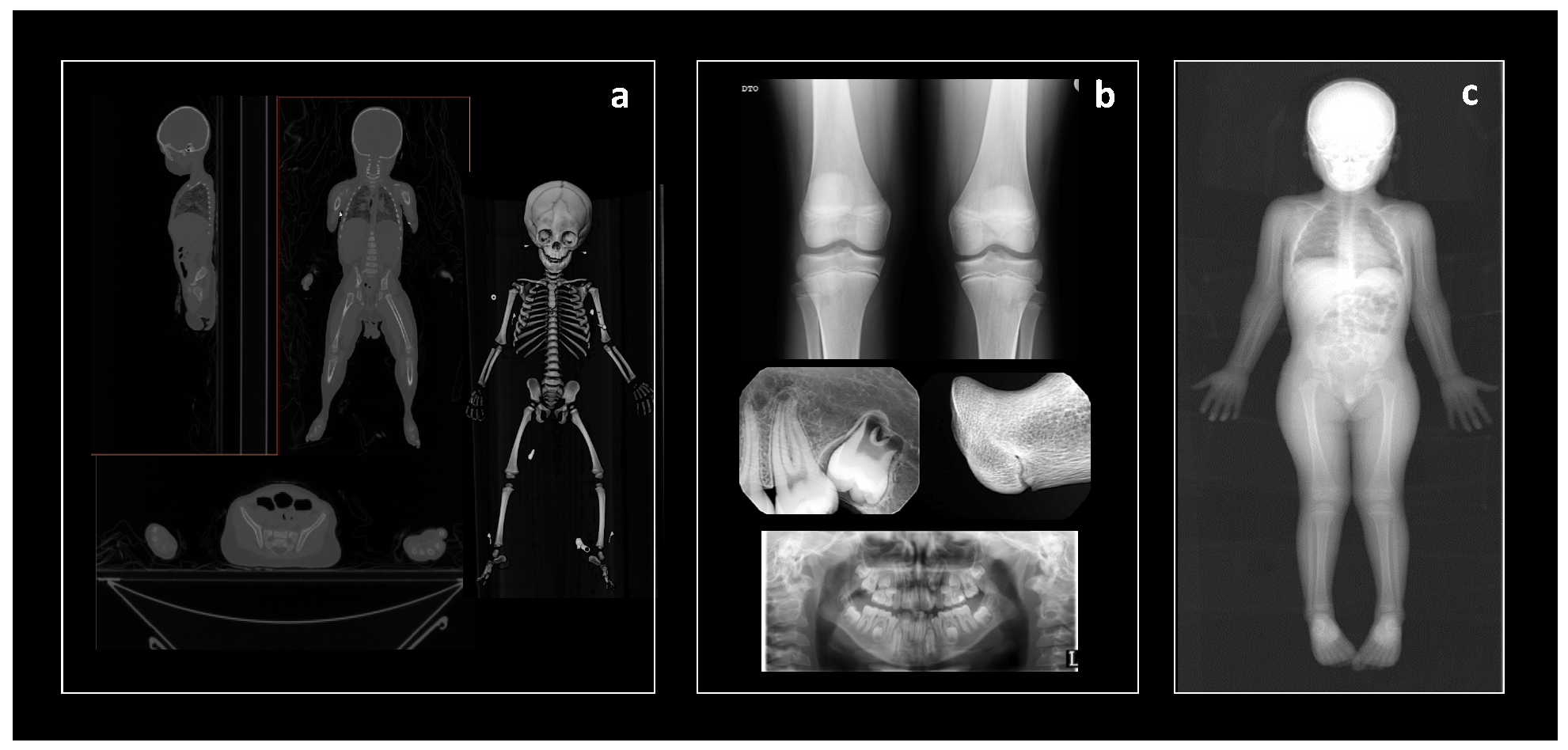 Forensicsci 02 00003 g002