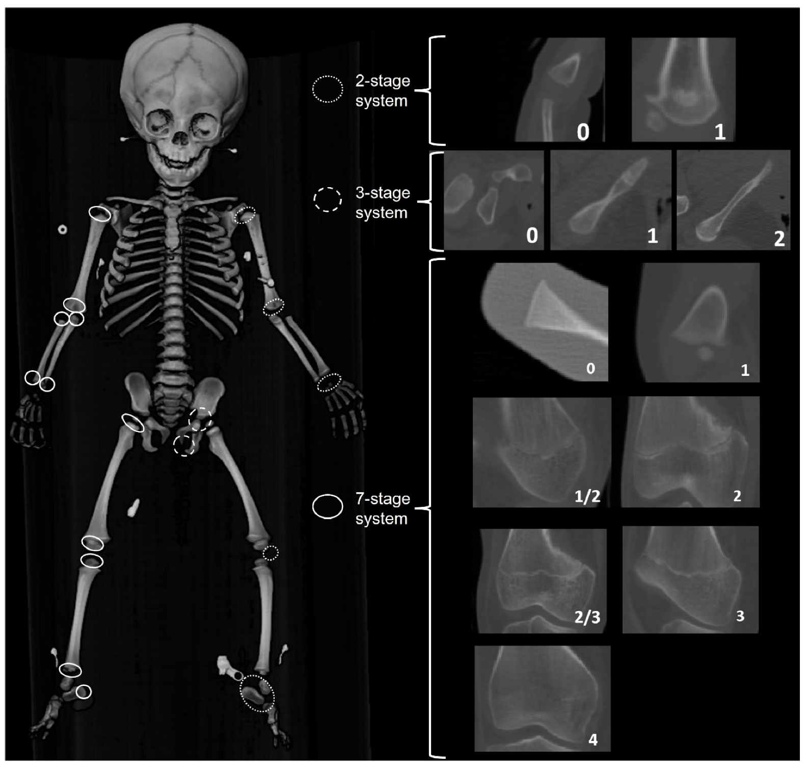 Forensicsci 02 00003 g008