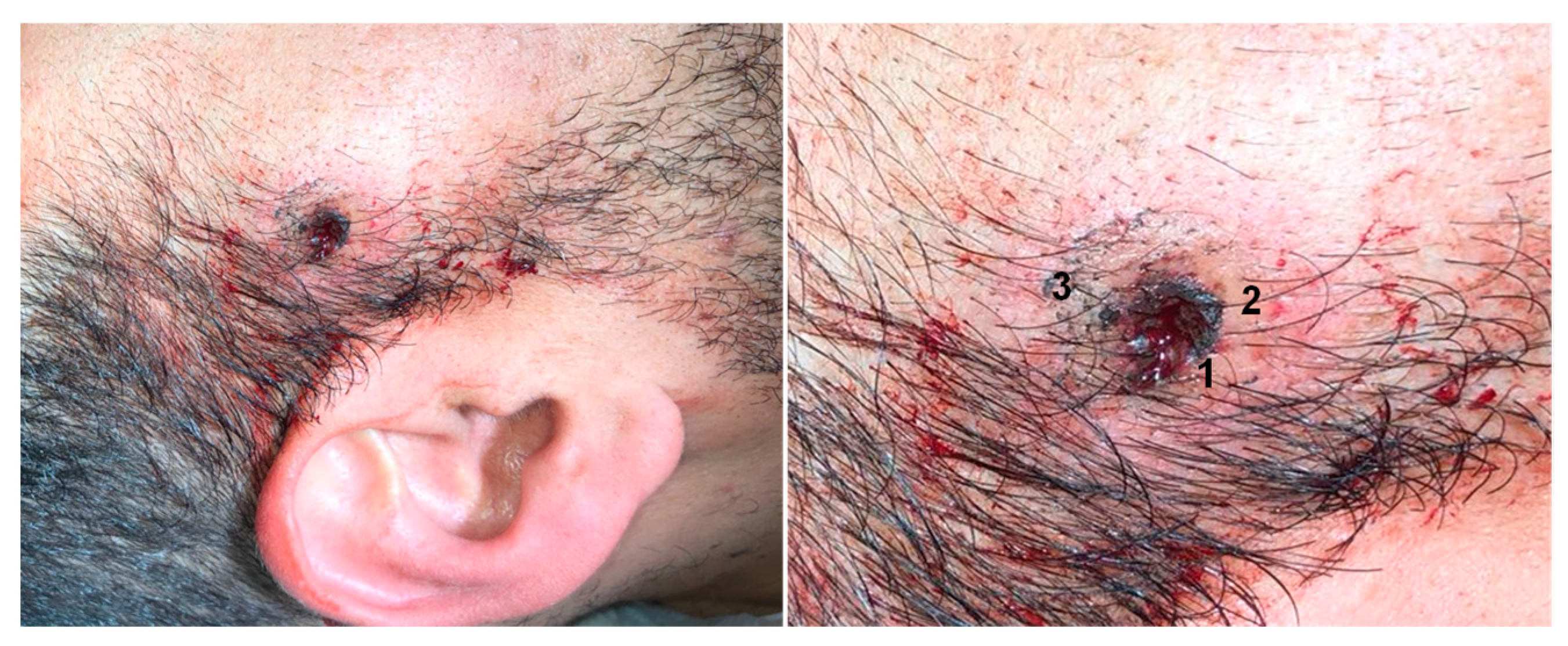 Forensicsci 02 00008 g001 550