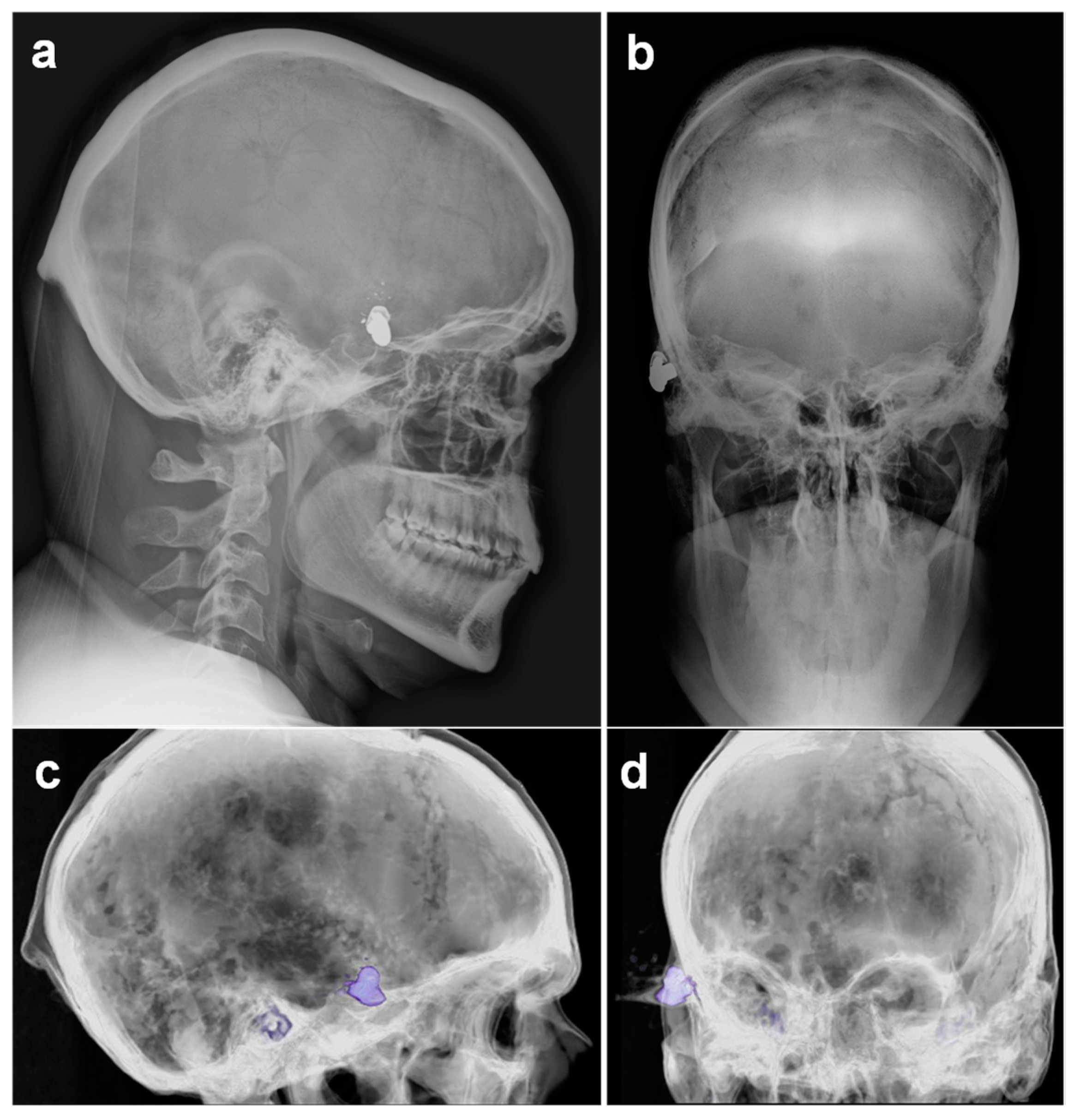 Forensicsci 02 00008 g002 550