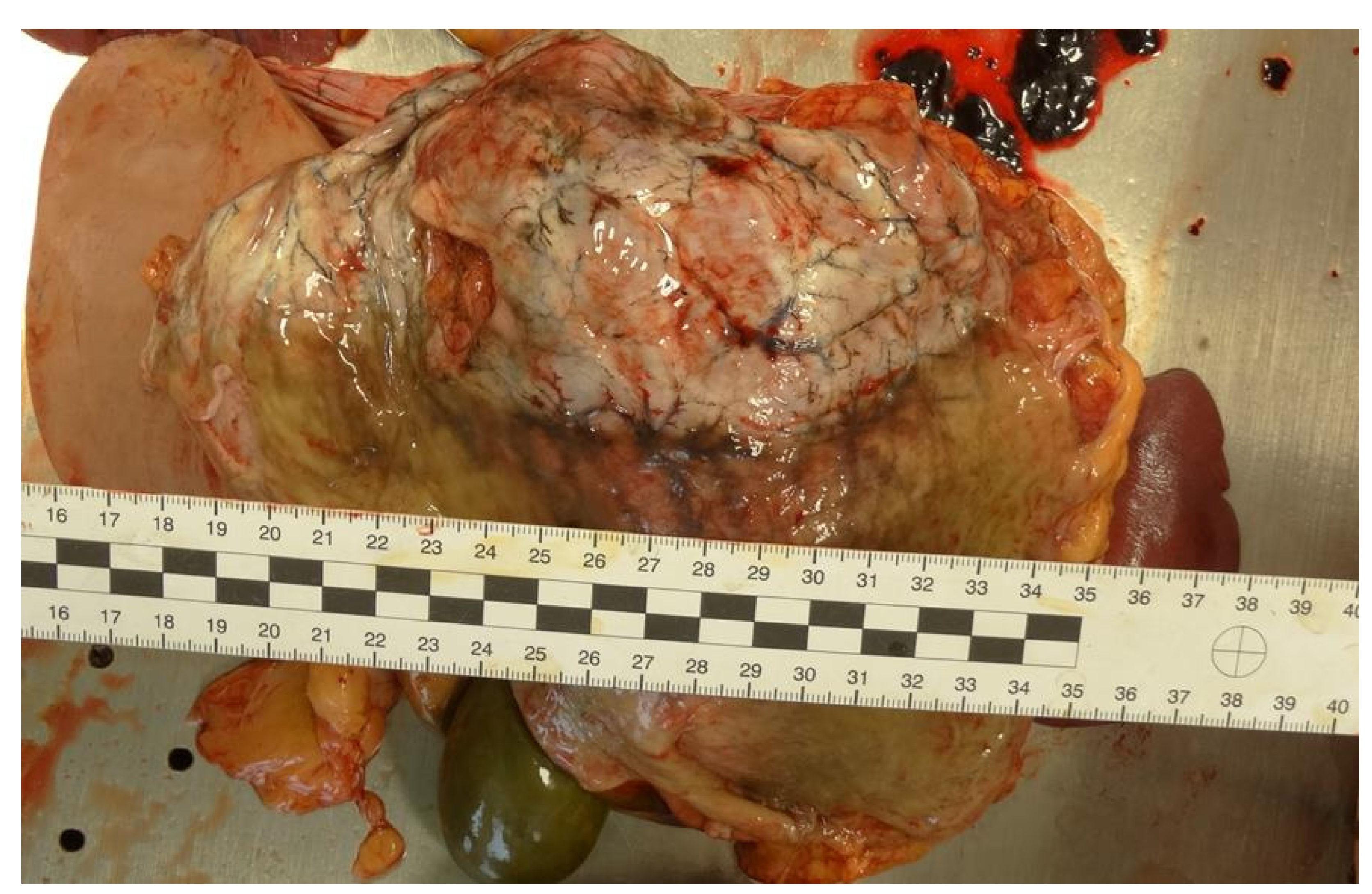 Forensicsci 02 00011 g002