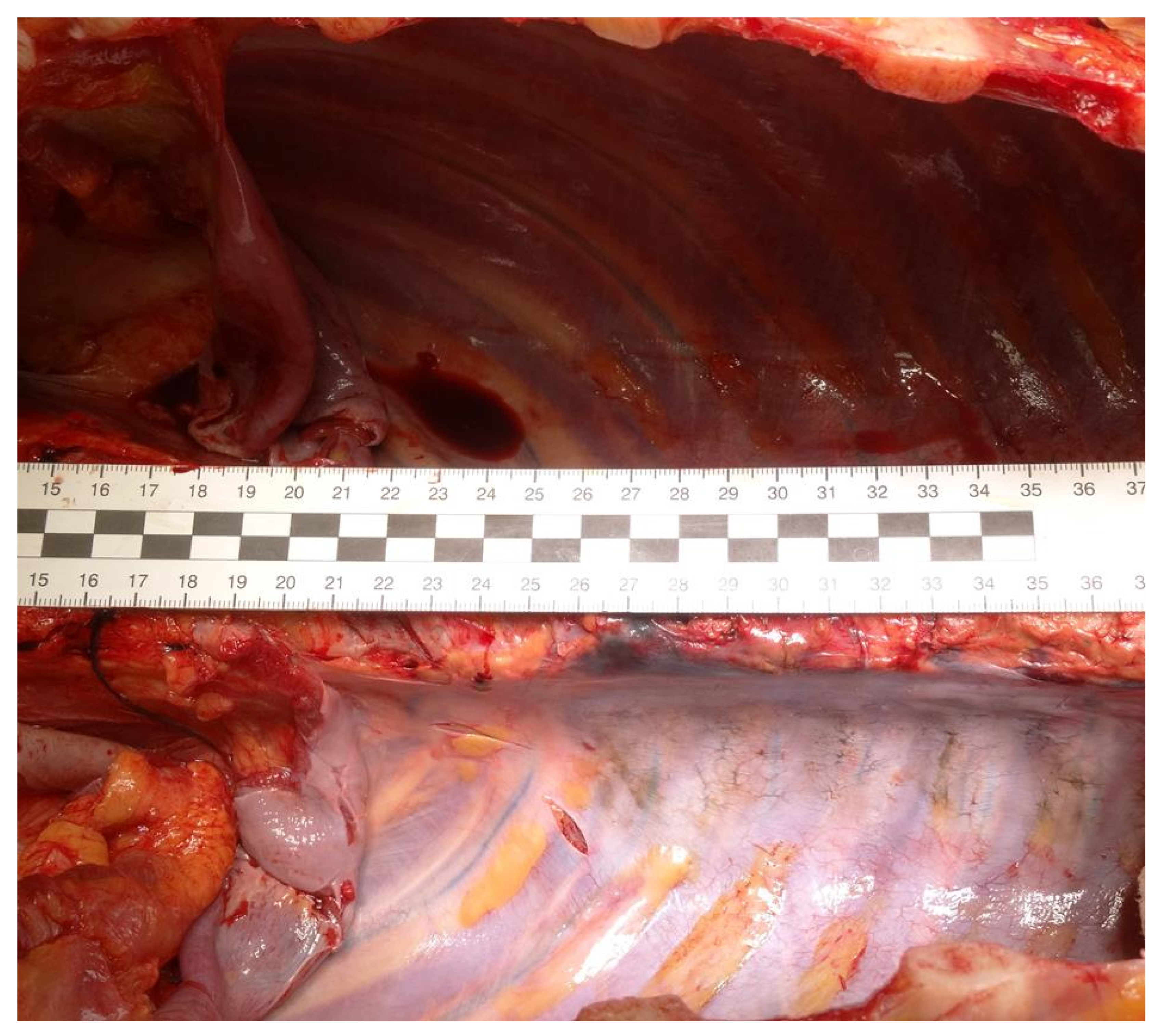 Forensicsci 02 00011 g003