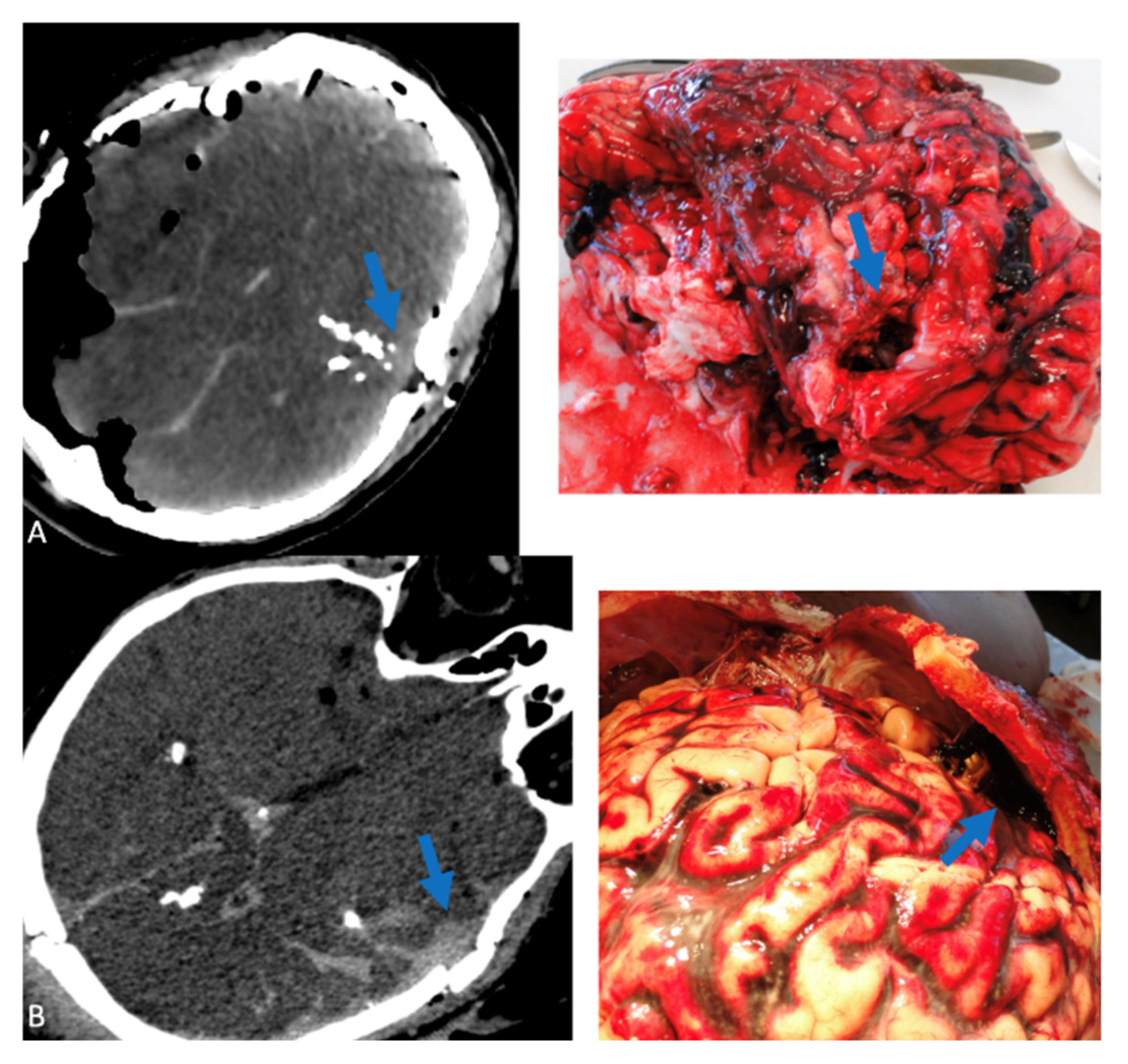 Forensicsci 02 00015 g001