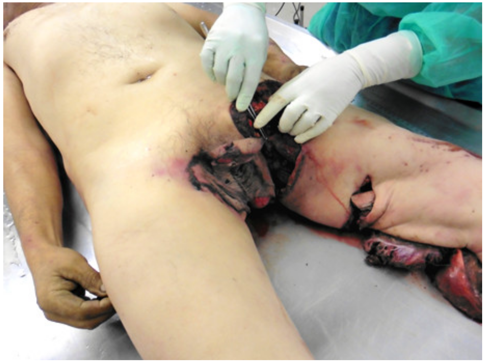 Forensic Sciences