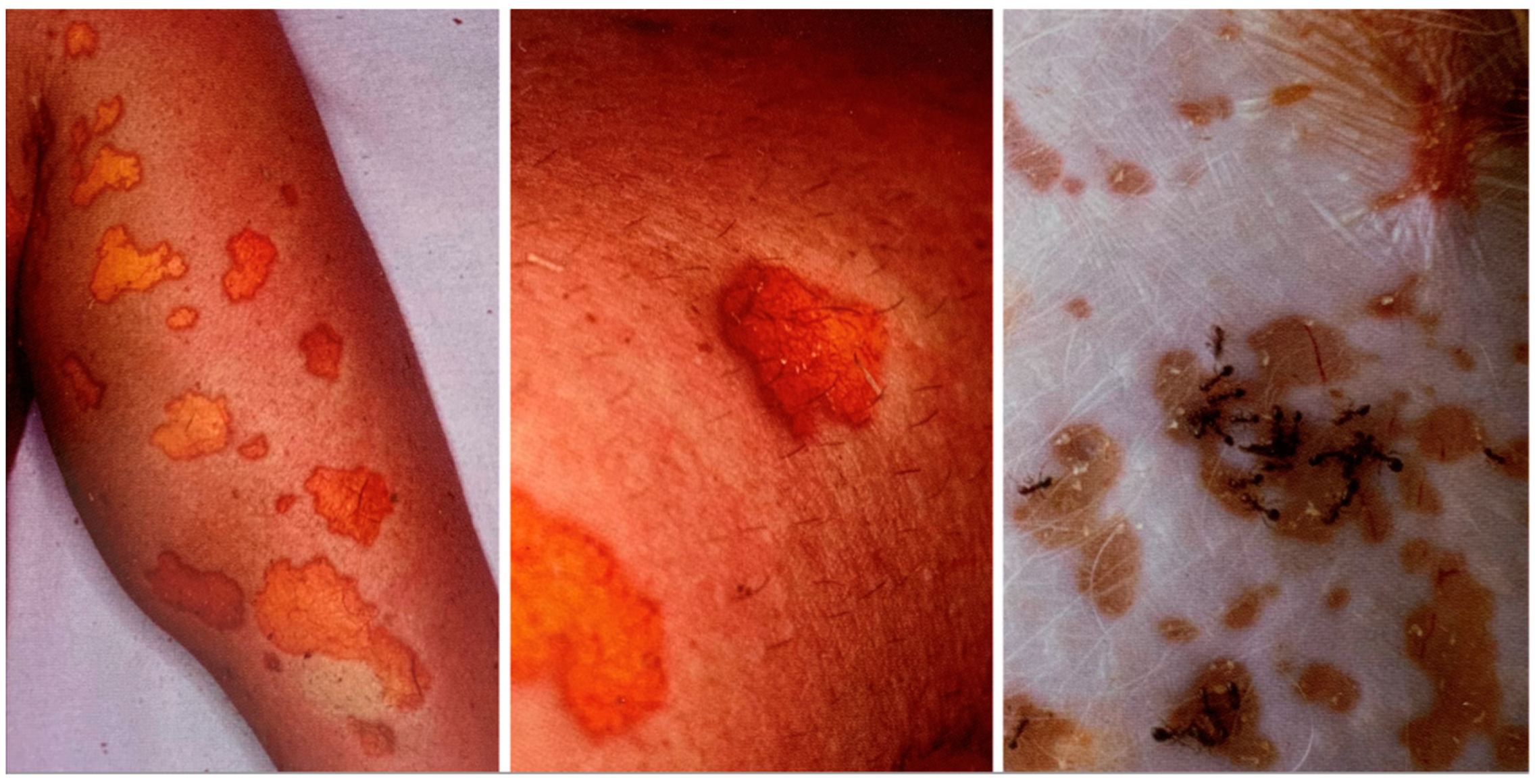 Forensicsci 02 00054 g002