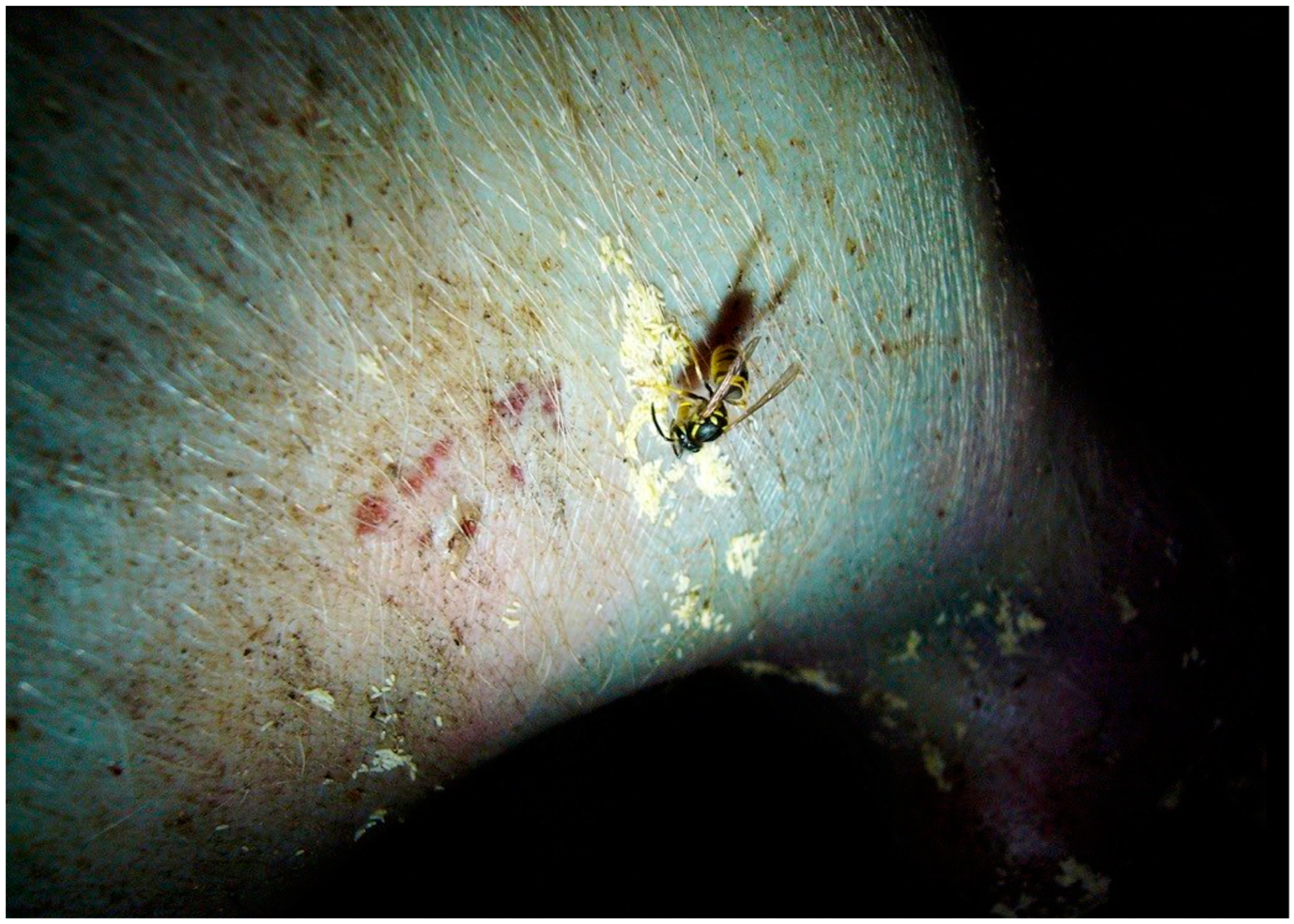 Forensicsci 02 00054 g015