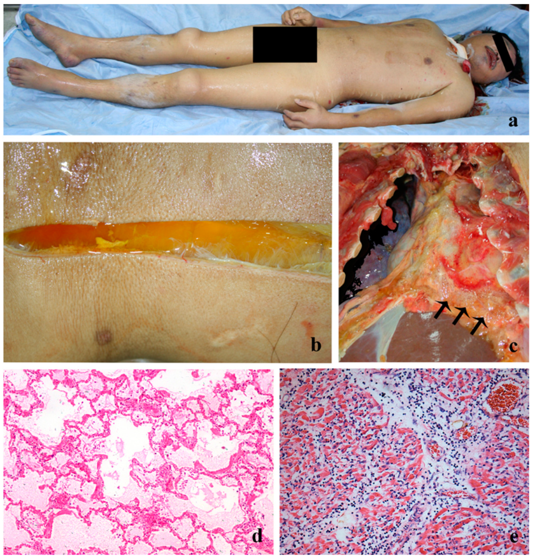 Forensicsci 03 00005 g002