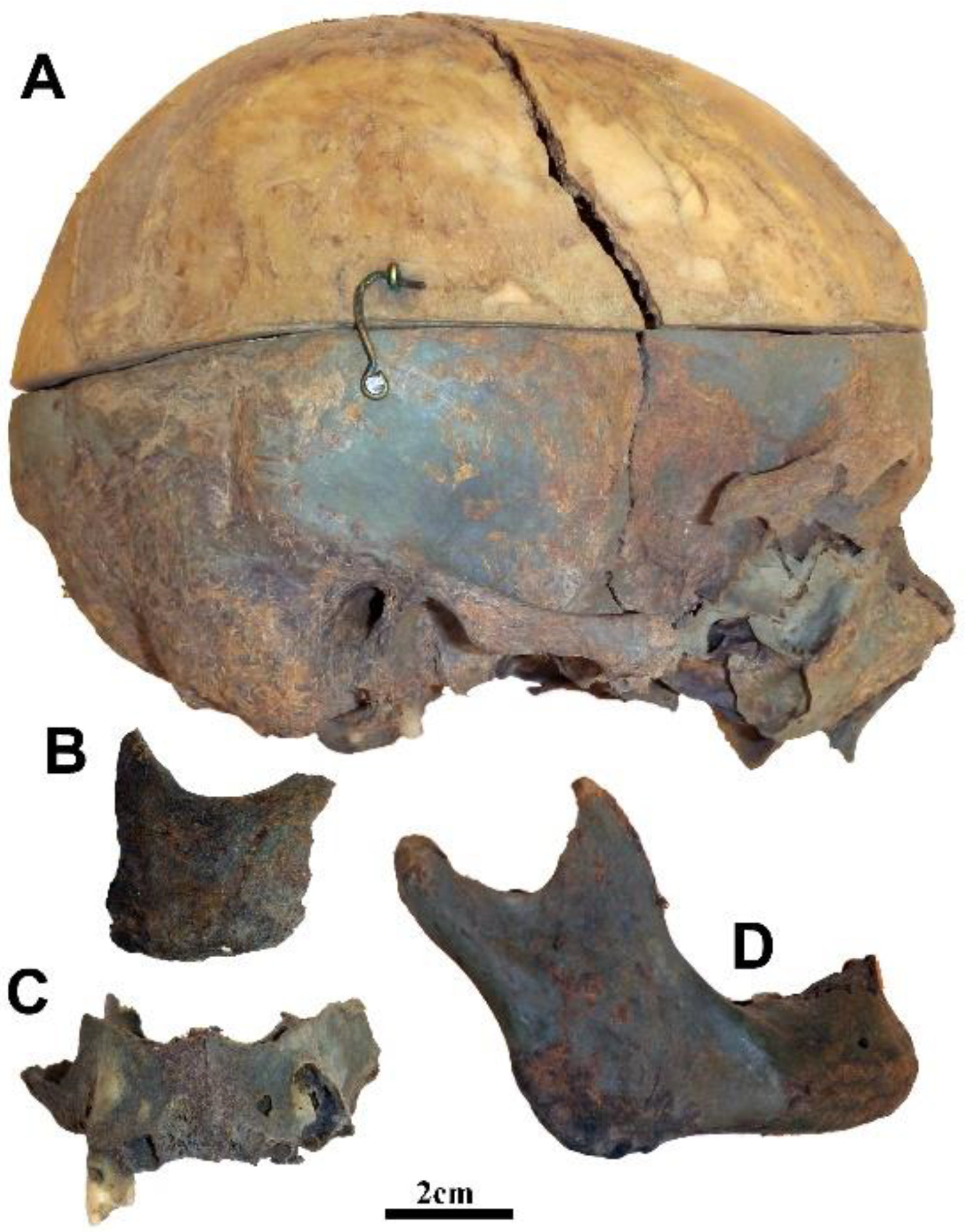 Forensicsci 03 00018 g002