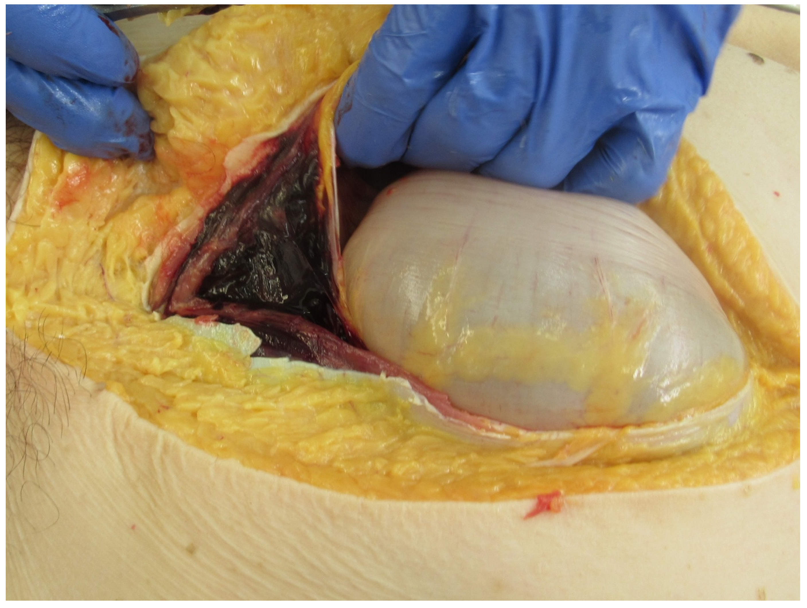 Forensicsci 04 00027 g001 Forensicsci 04 00027 g001