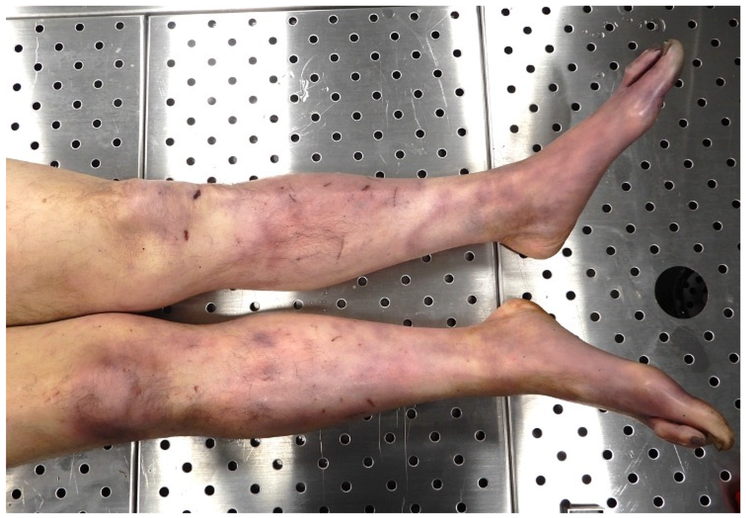 Forensicsci 04 00037 g005