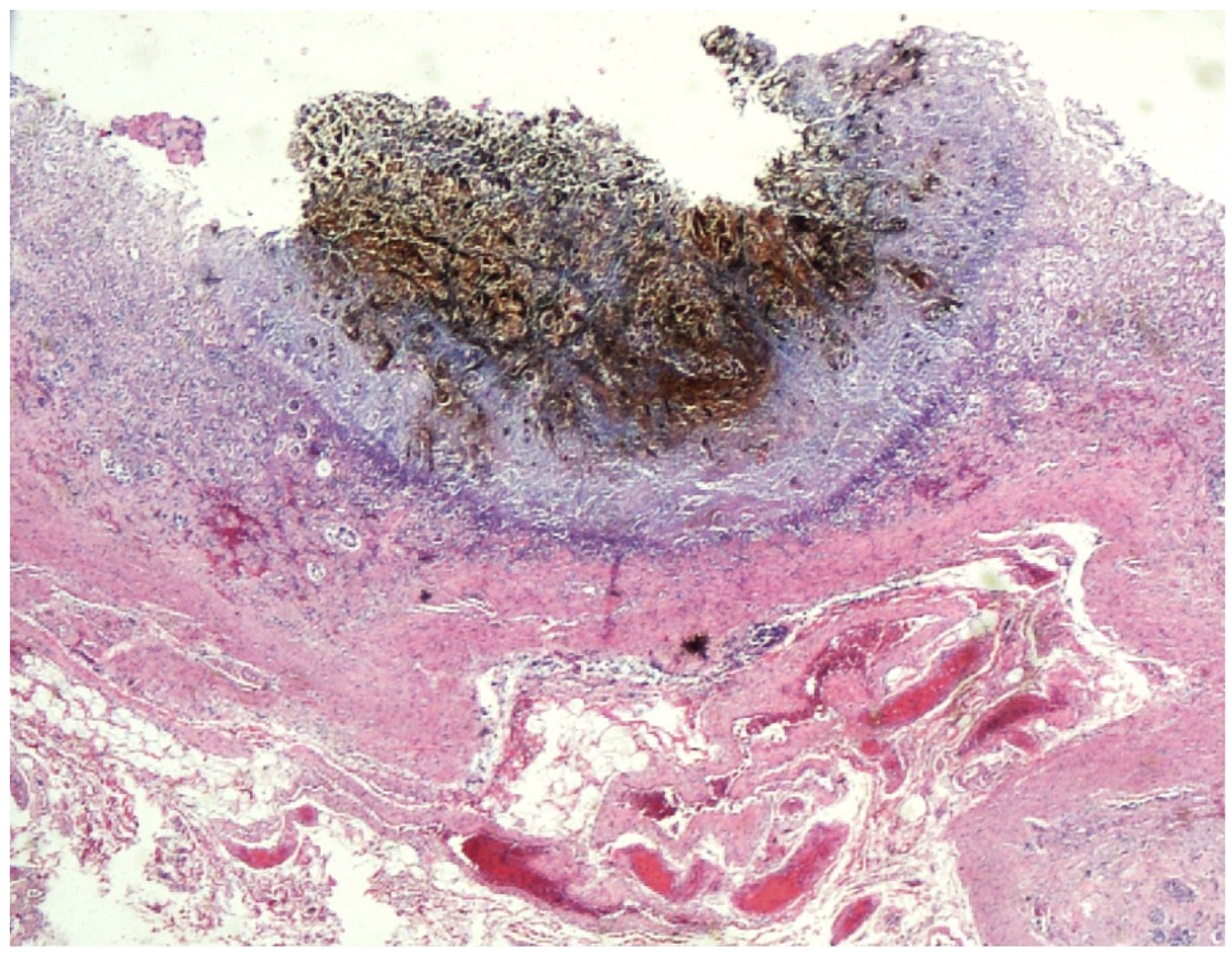 Forensicsci 04 00037 g010