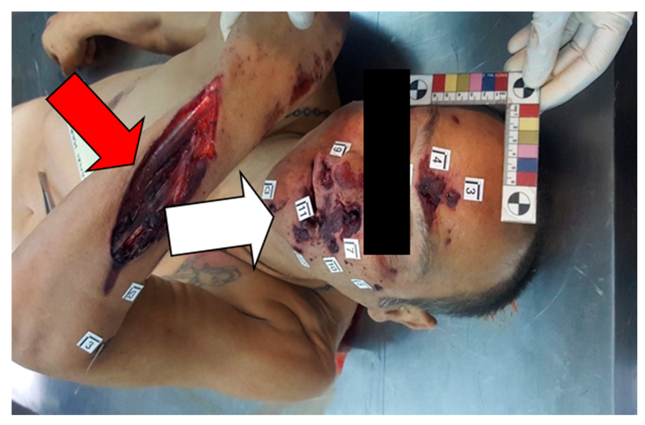 Forensicsci 04 00040 g001