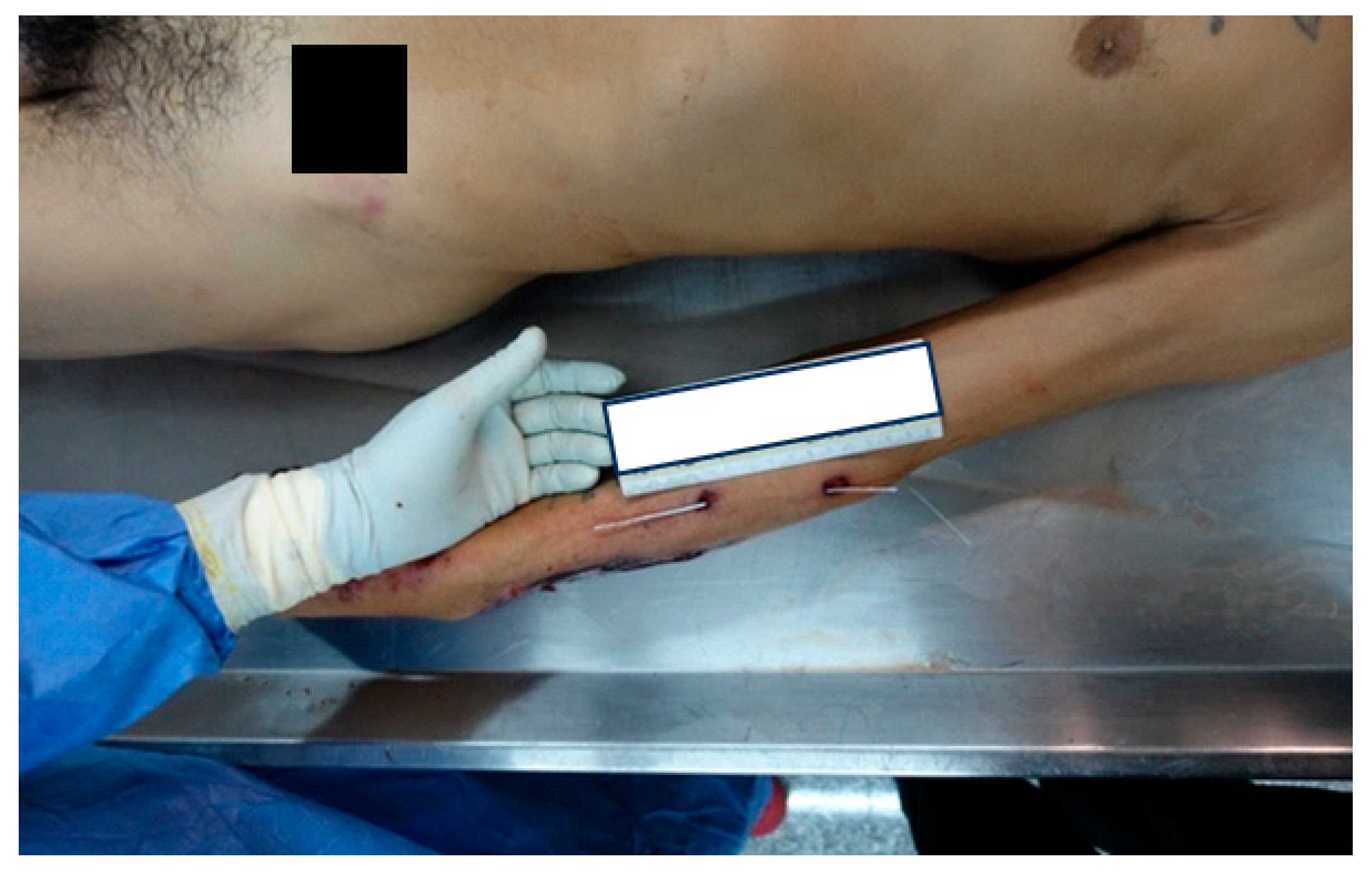 Forensicsci 04 00040 g002