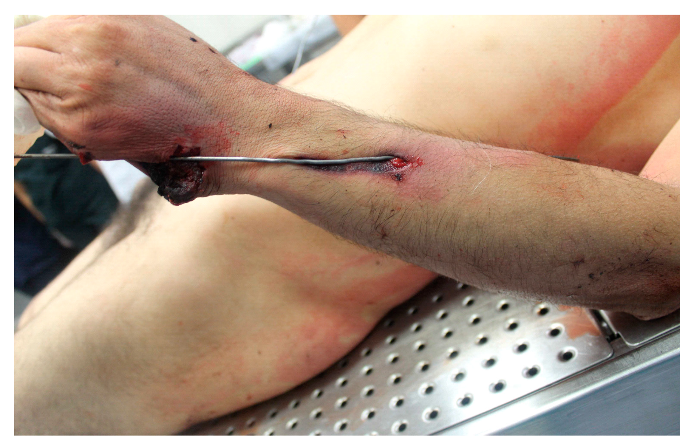 Forensicsci 04 00040 g005