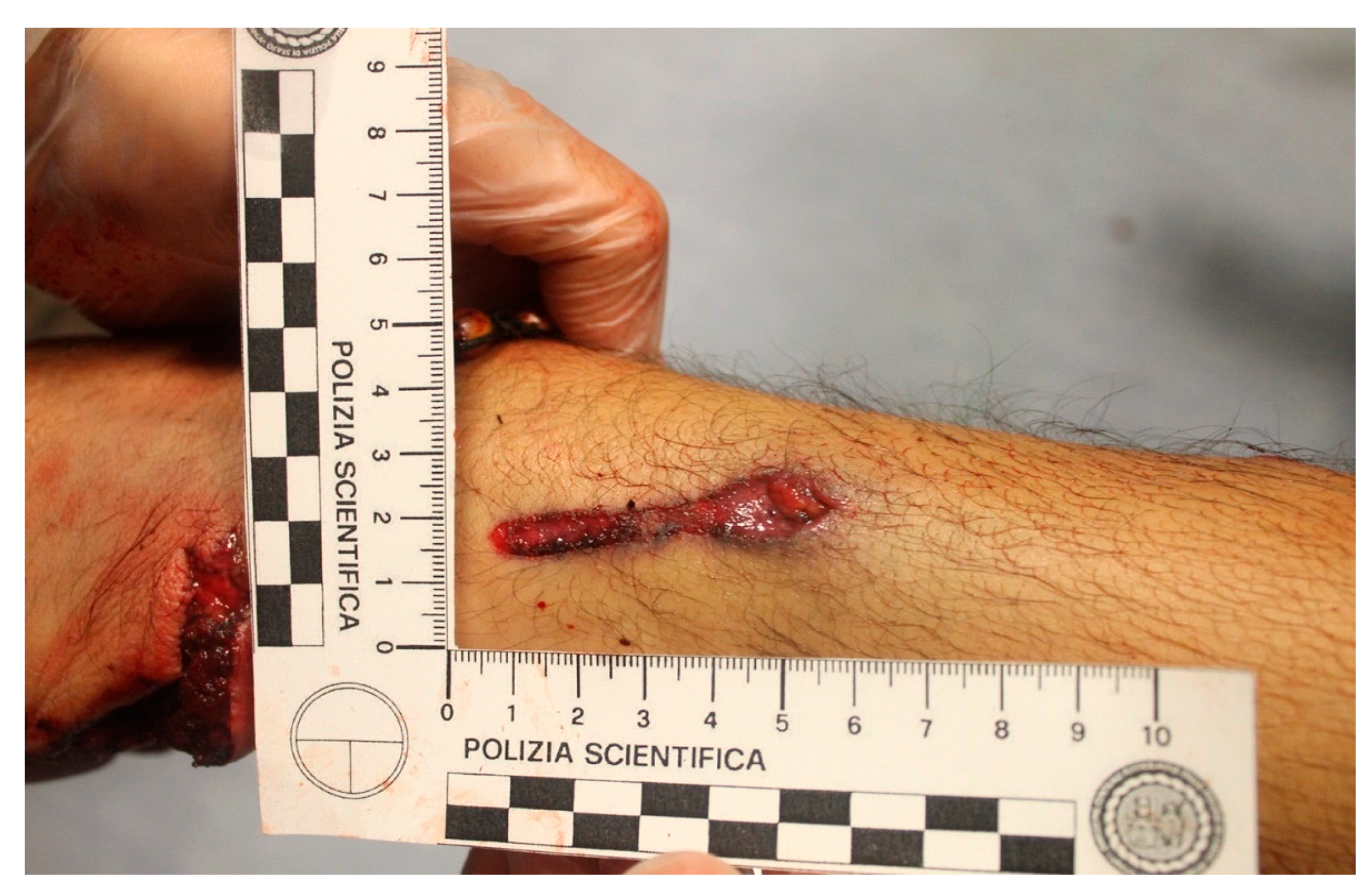 Forensicsci 04 00040 g006