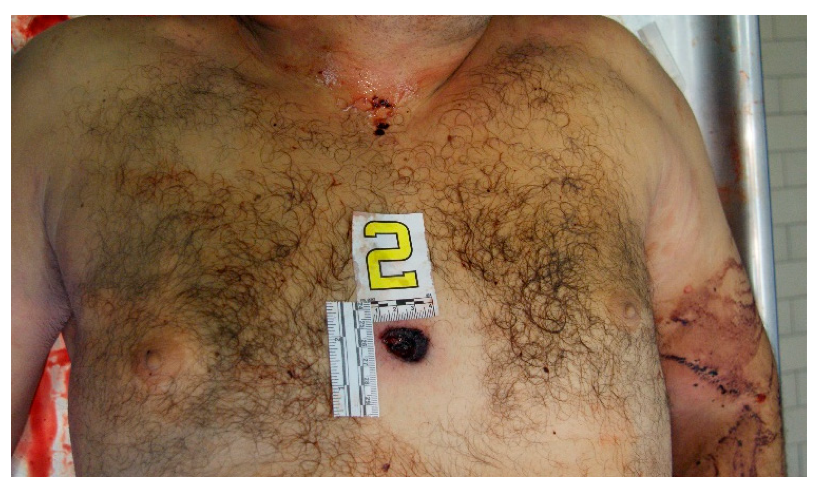 Forensicsci 04 00040 g011