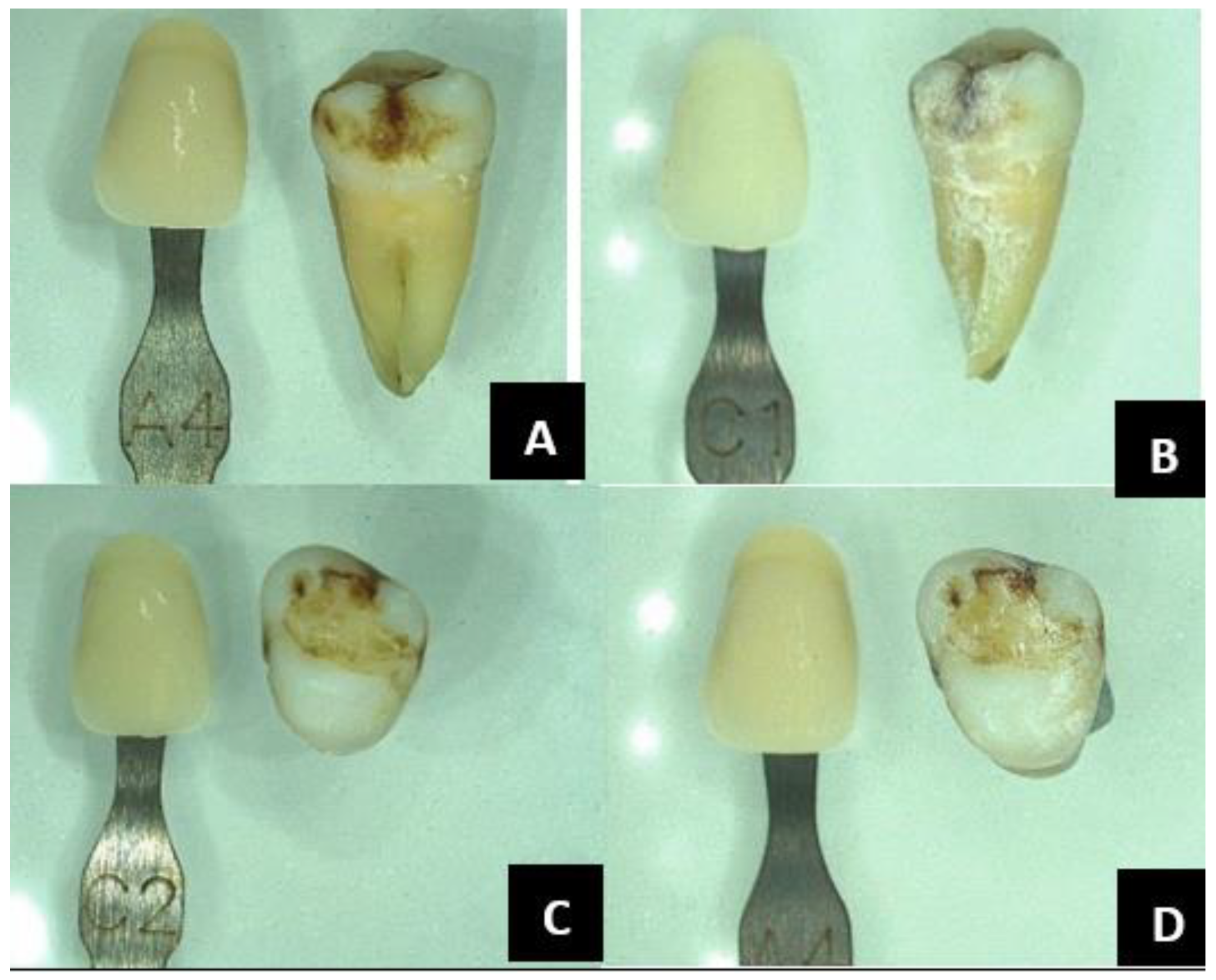 Forensicsci 05 00012 g004 Forensicsci 05 00012 g004