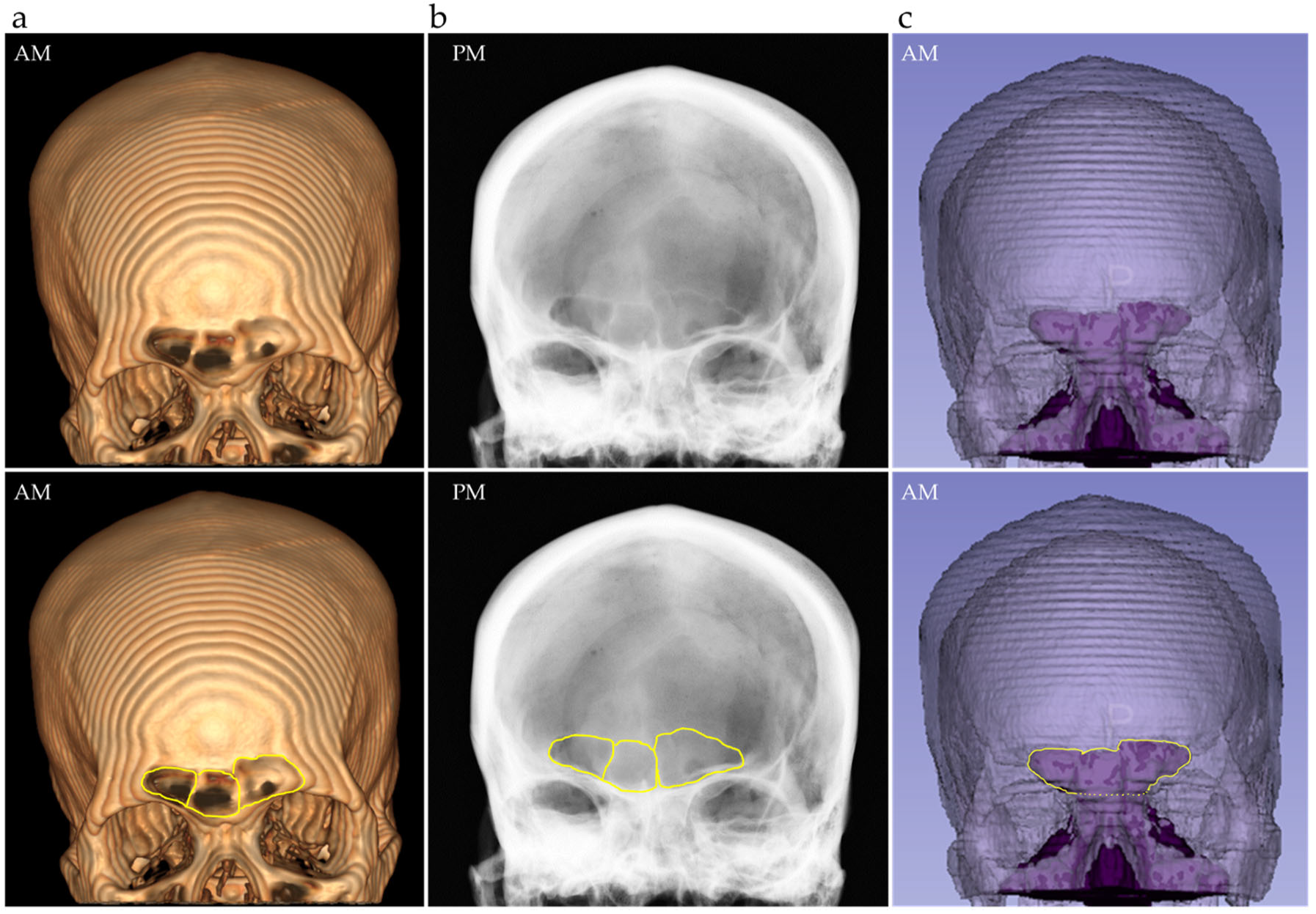 Forensicsci 05 00035 g003
