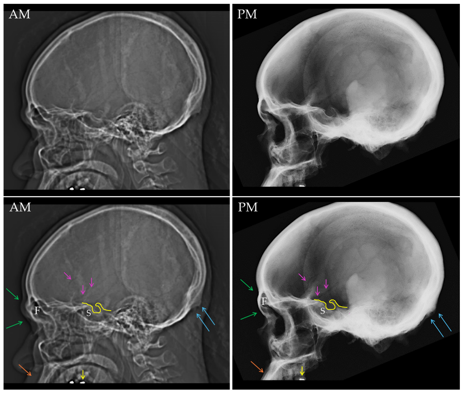 Forensicsci 05 00035 g006