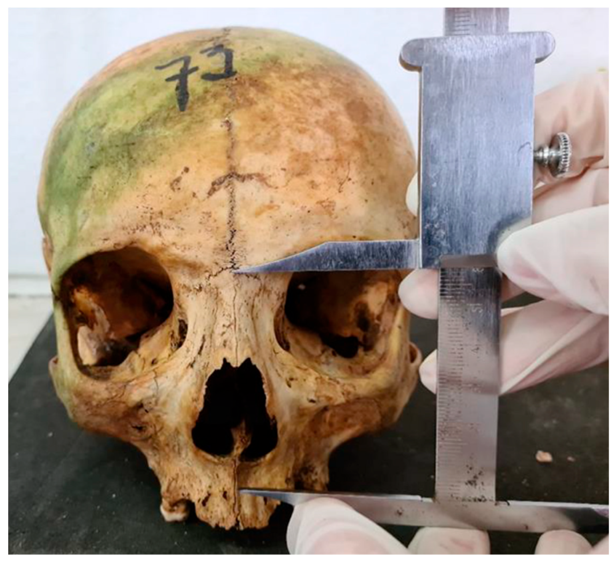 Forensicsci 05 00037 g003