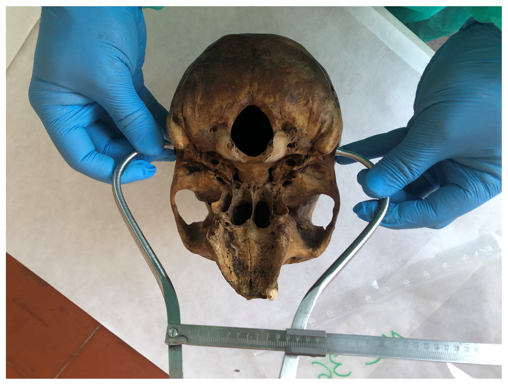 Forensicsci 05 00037 g004