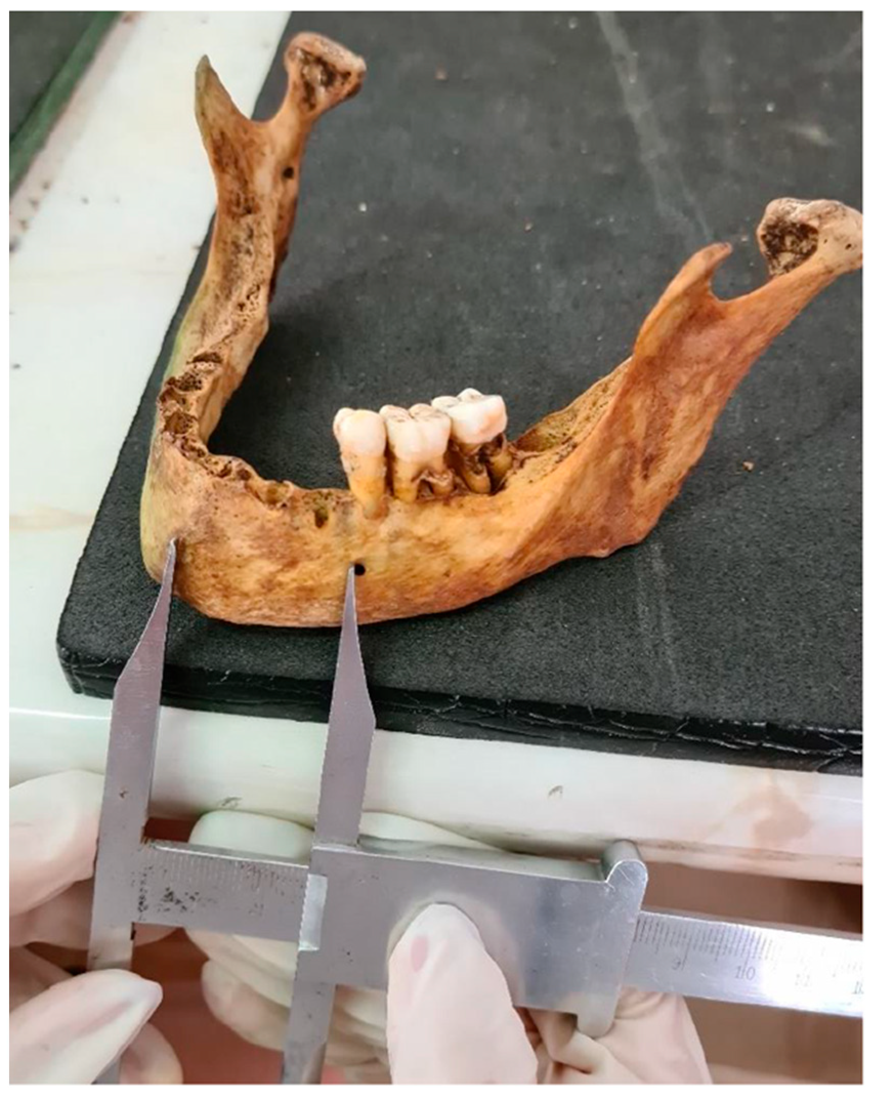 Forensicsci 05 00037 g005