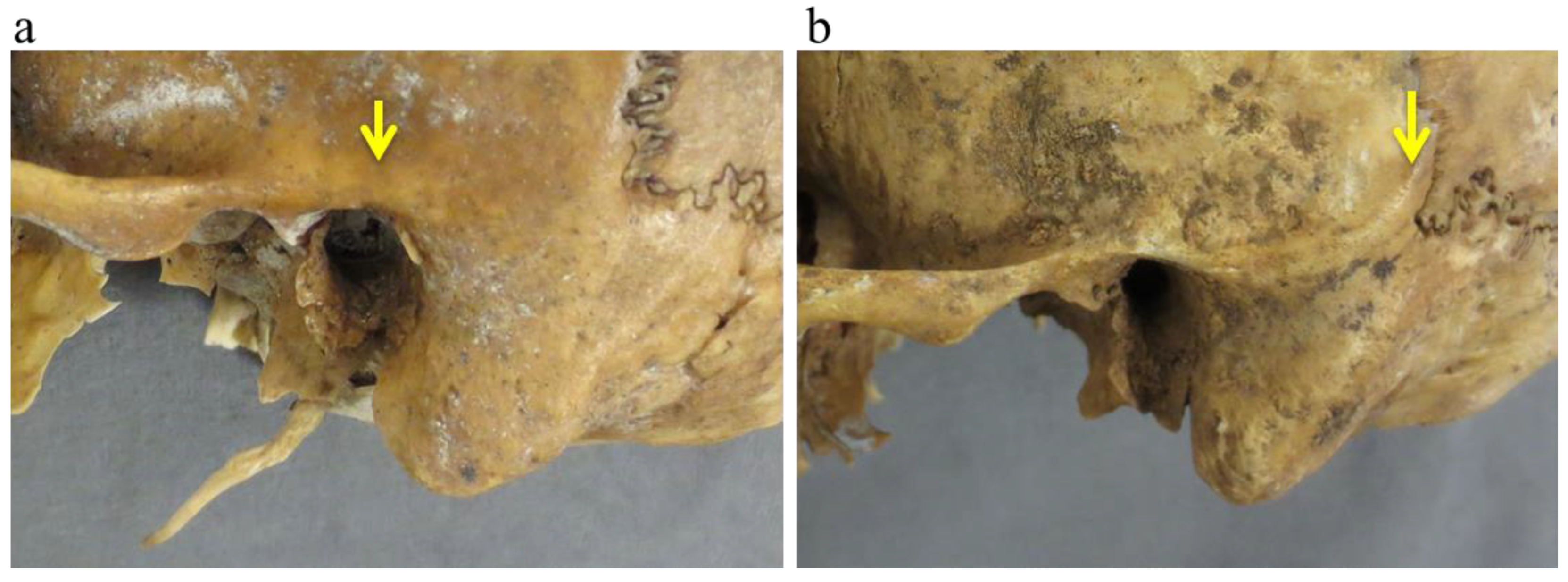 Forensicsci 05 00060 g002 Forensicsci 05 00060 g002