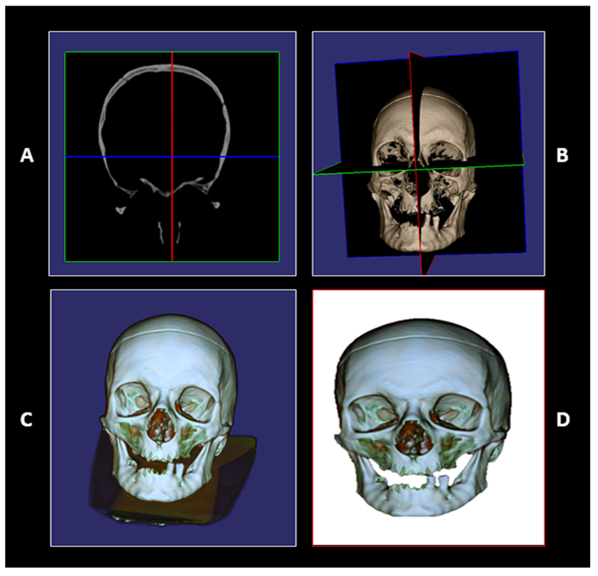Forensicsci 05 00067 g002