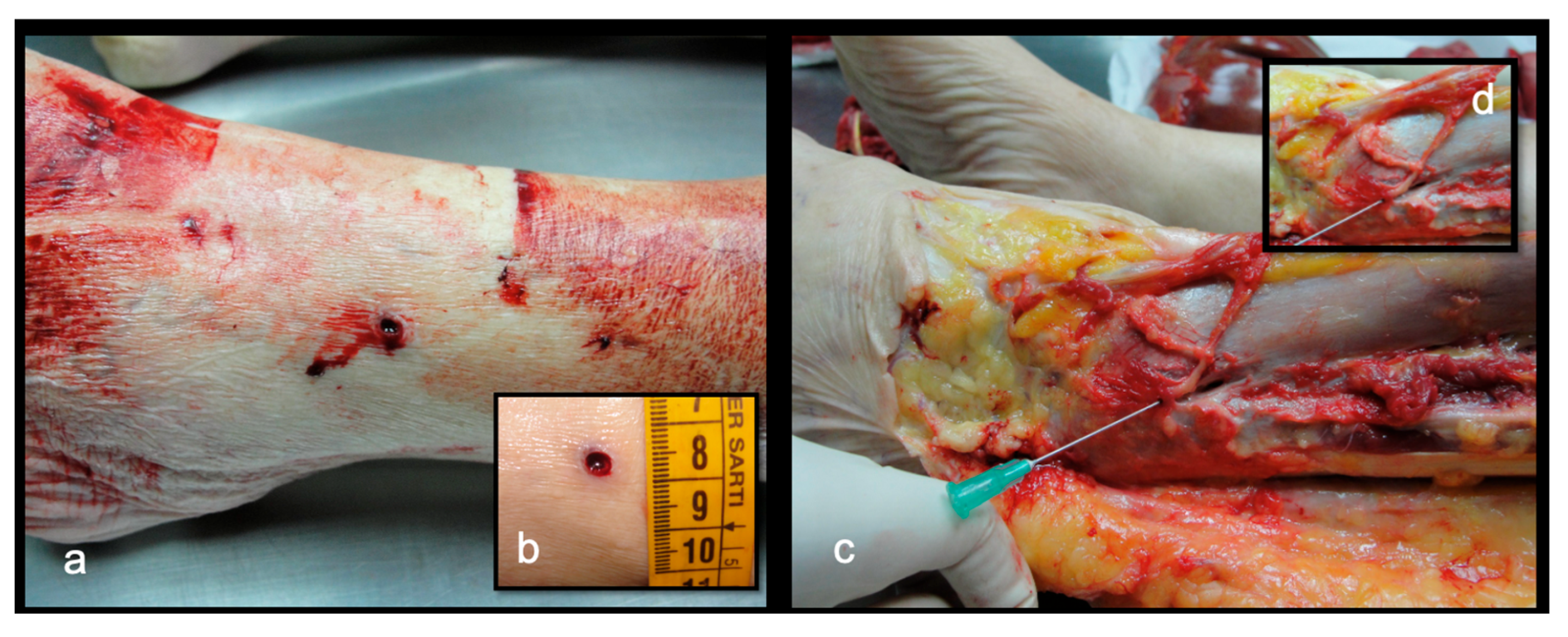 Forensicsci 05 00070 g003
