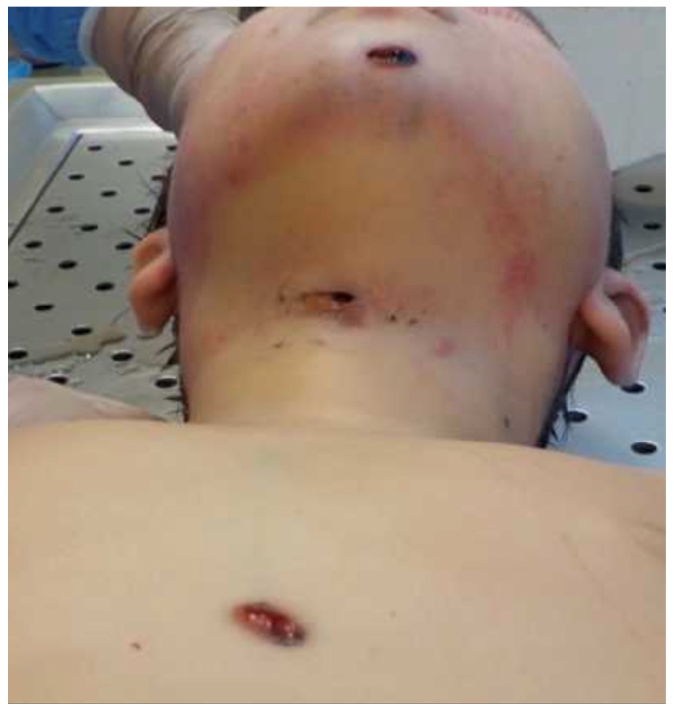 Forensicsci 05 00080 g005 Forensicsci 05 00080 g005