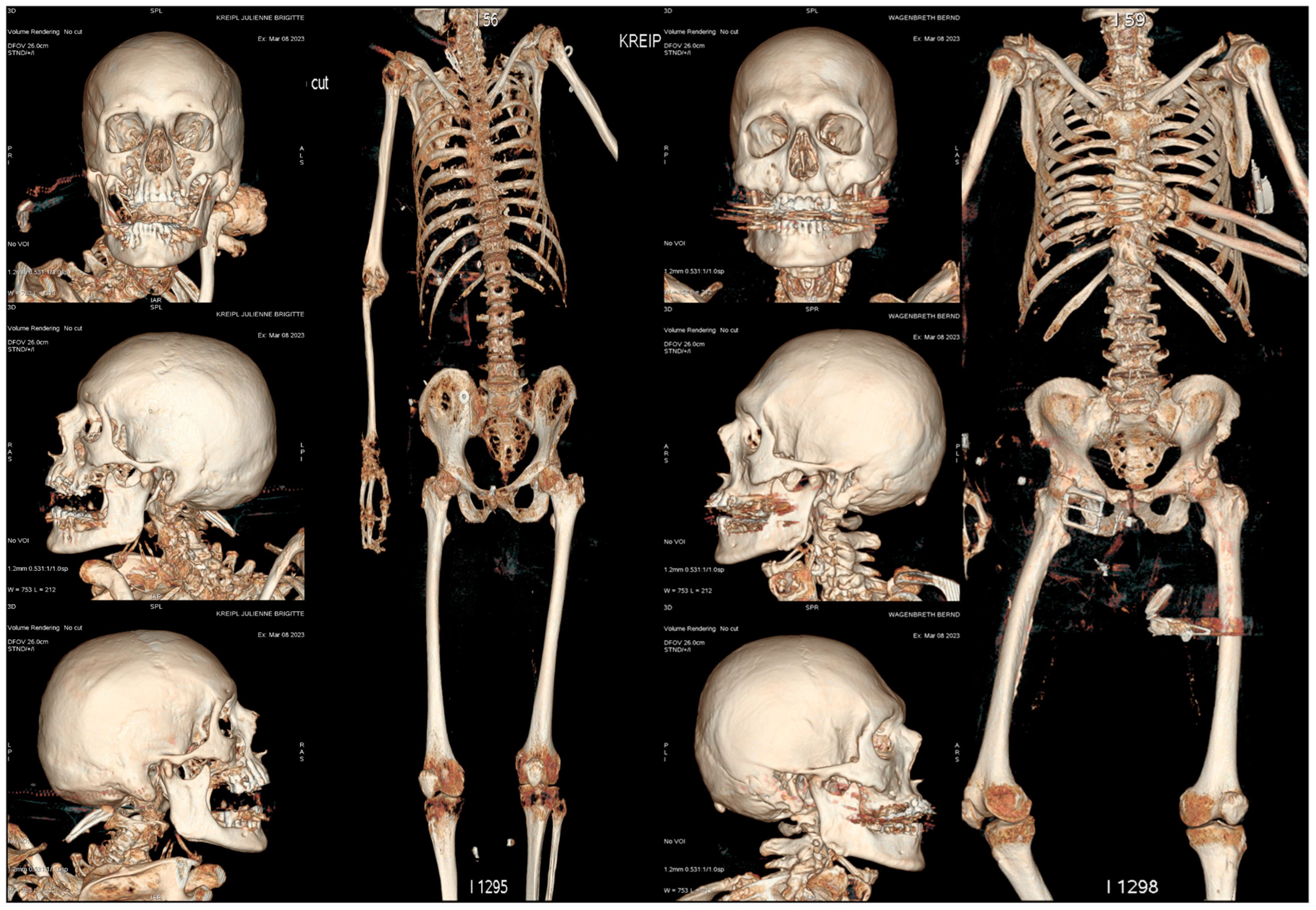 Forensicsci 06 00005 g003