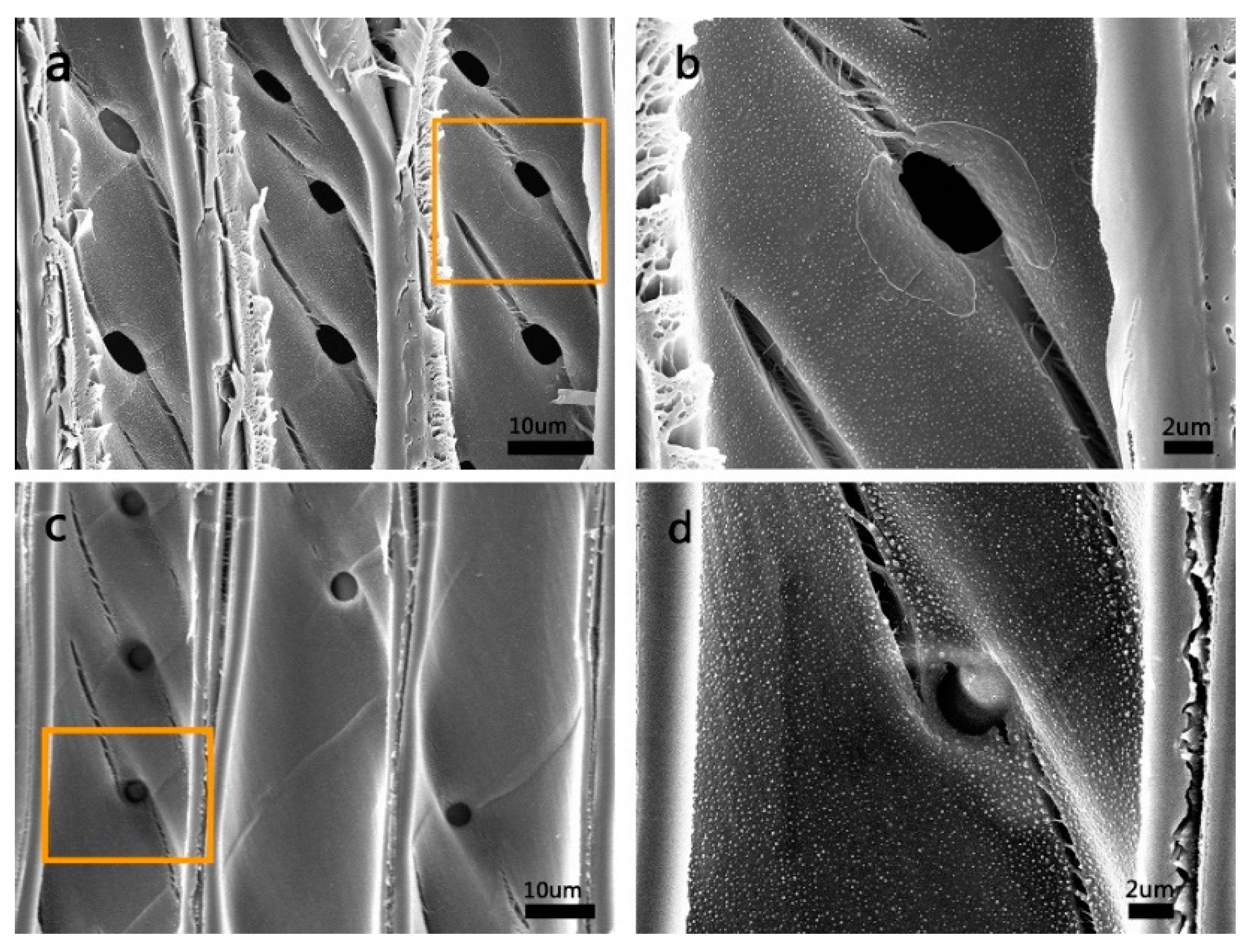 Scanning electron micrographs of transverse sections through